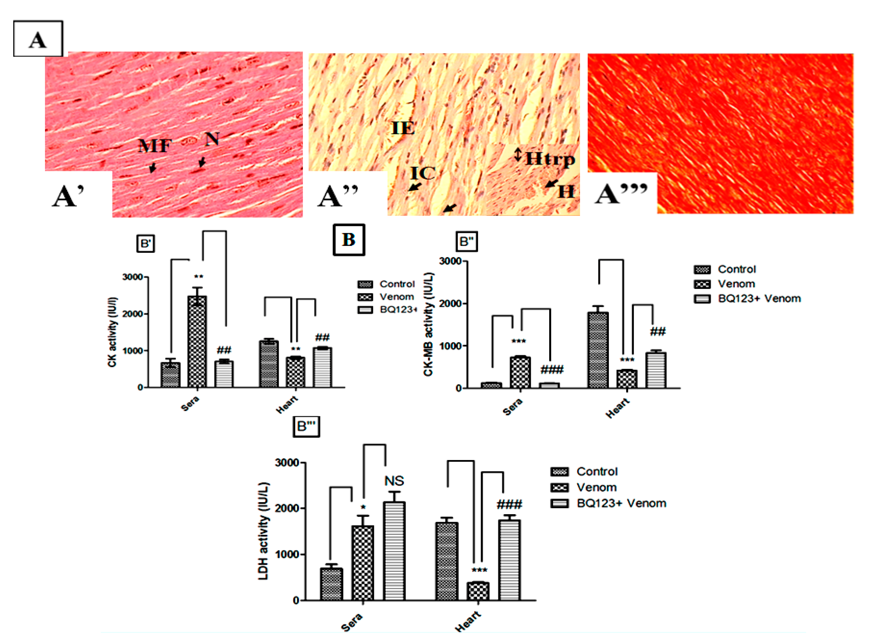 Toxins Free Full Text Involvement Of The Endothelin Receptor Type A In The Cardiovascular Inflammatory Response Following Scorpion Envenomation Html