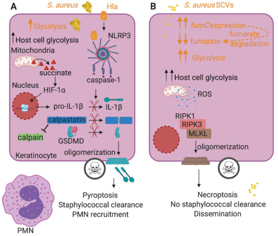 Molecular Pathogenesis of Staphylococcus aureus Infection