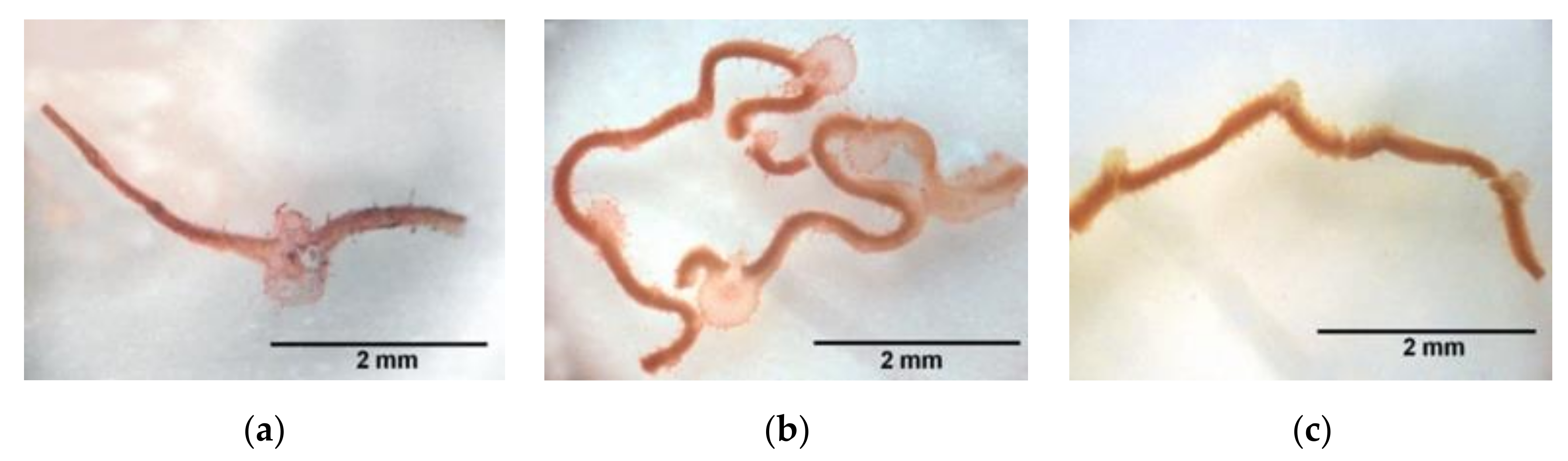 Toxins 12 00585 g004