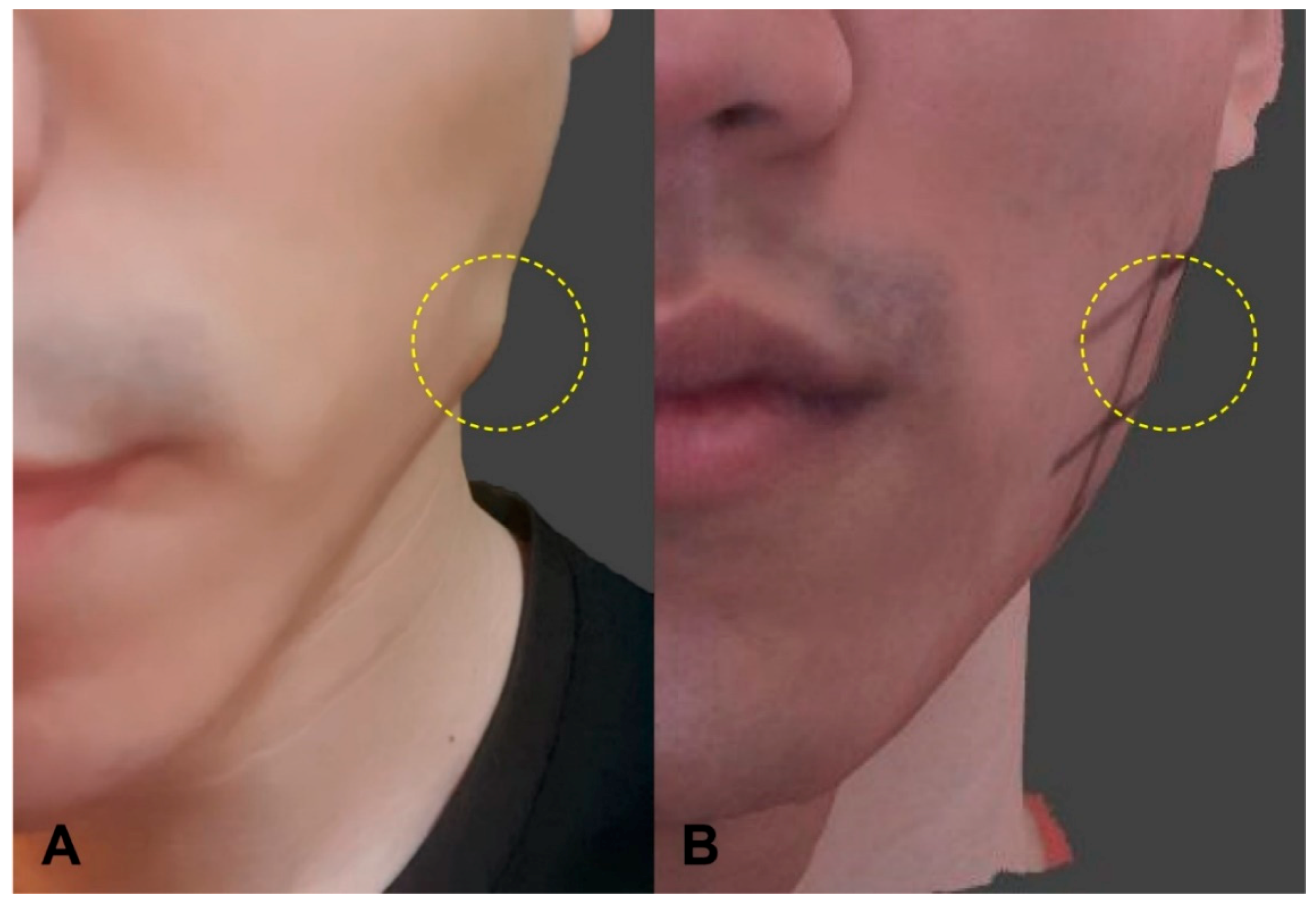 Toxins 12 00588 g001