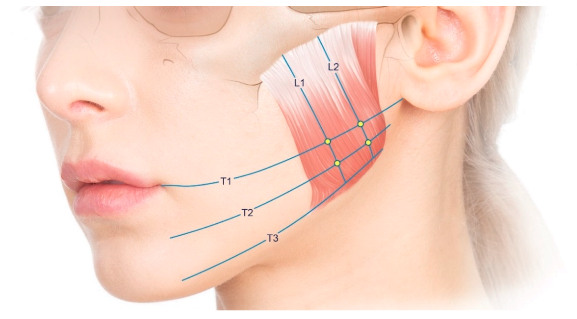 Toxins 12 00588 g004