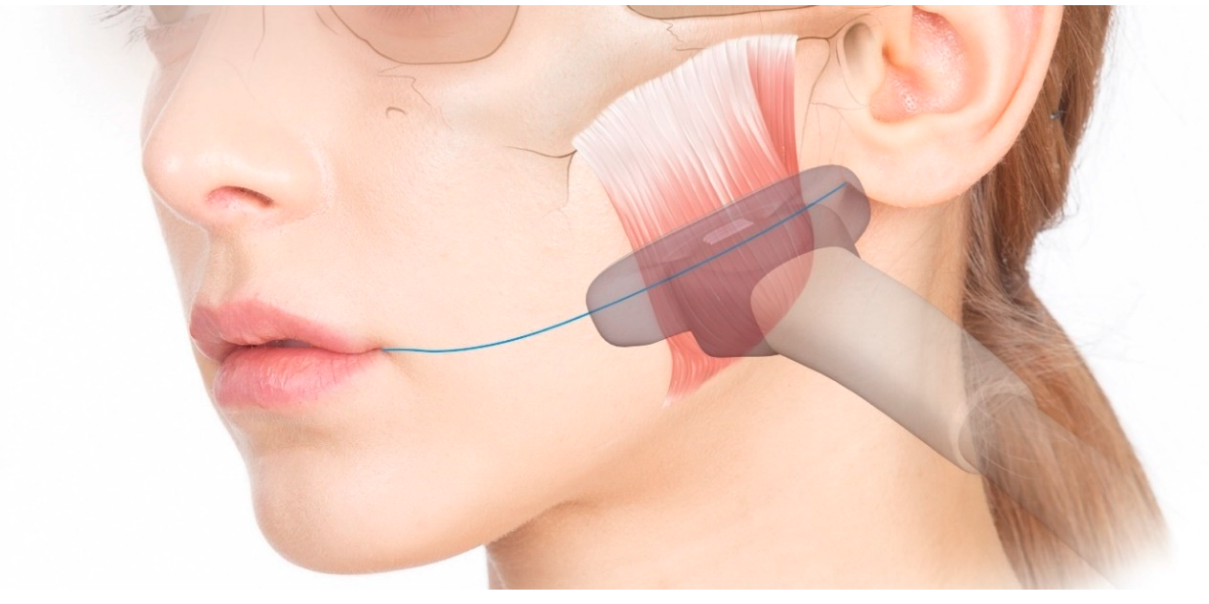 Toxins 12 00588 g007