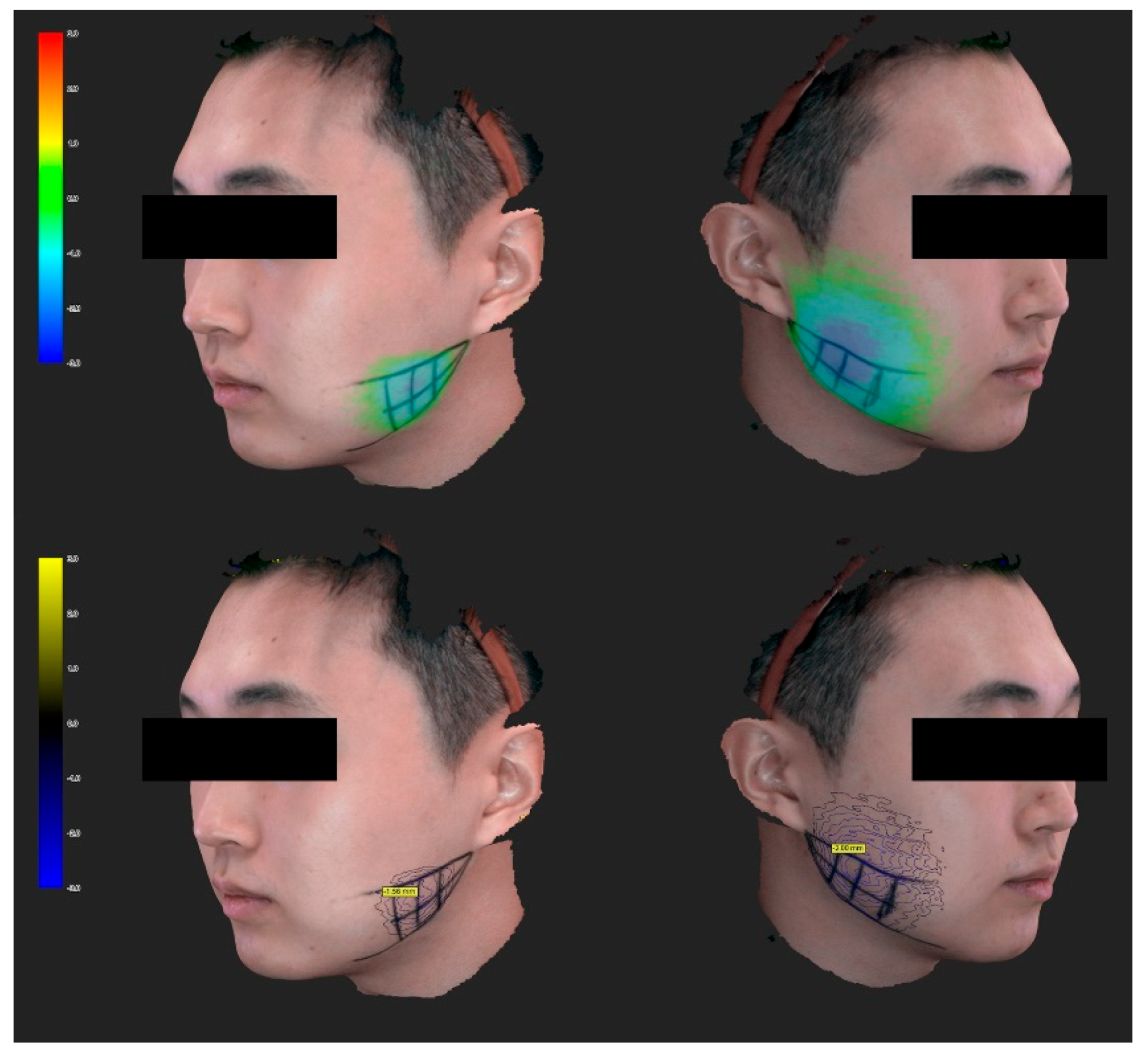 Toxins 12 00588 g008