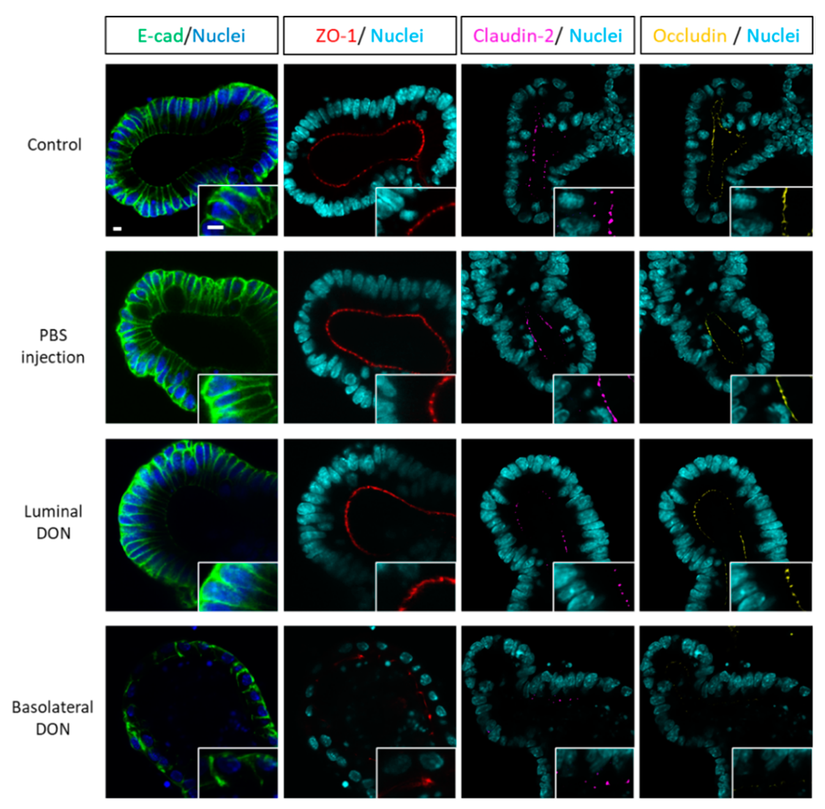 Toxins 12 00610 g003