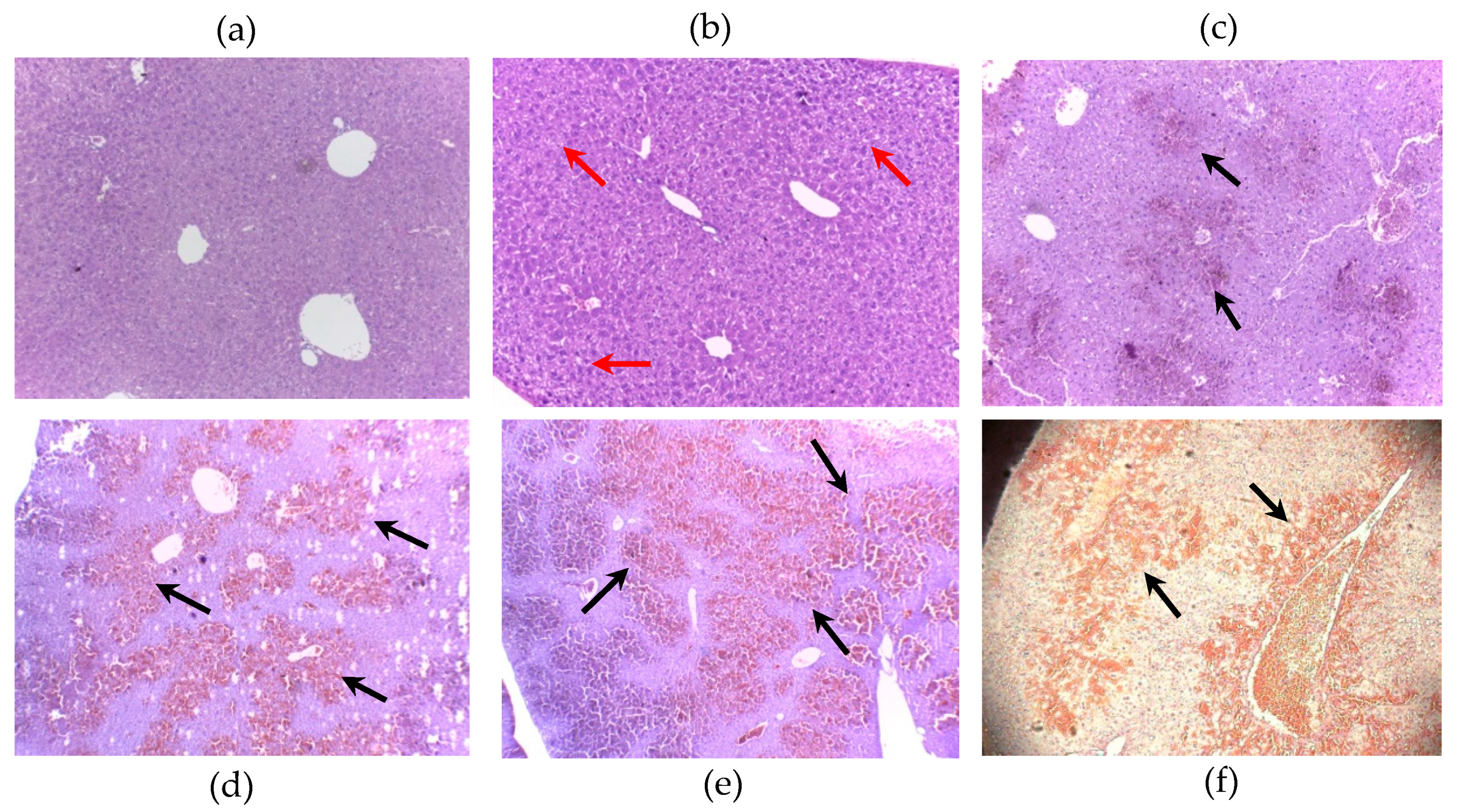 Toxins Free Full Text D Leu1 Mc Lr Has Lower Pp1 Inhibitory Capability And Greater Toxic Potency Than Mc Lr In Animal And Plant Tissues Html Toxins Free Full Text D Leu1 Mc Lr Has Lower Pp1 Inhibitory Capability And Greater Toxic Potency Than Mc Lr In Animal And Plant Tissues Html