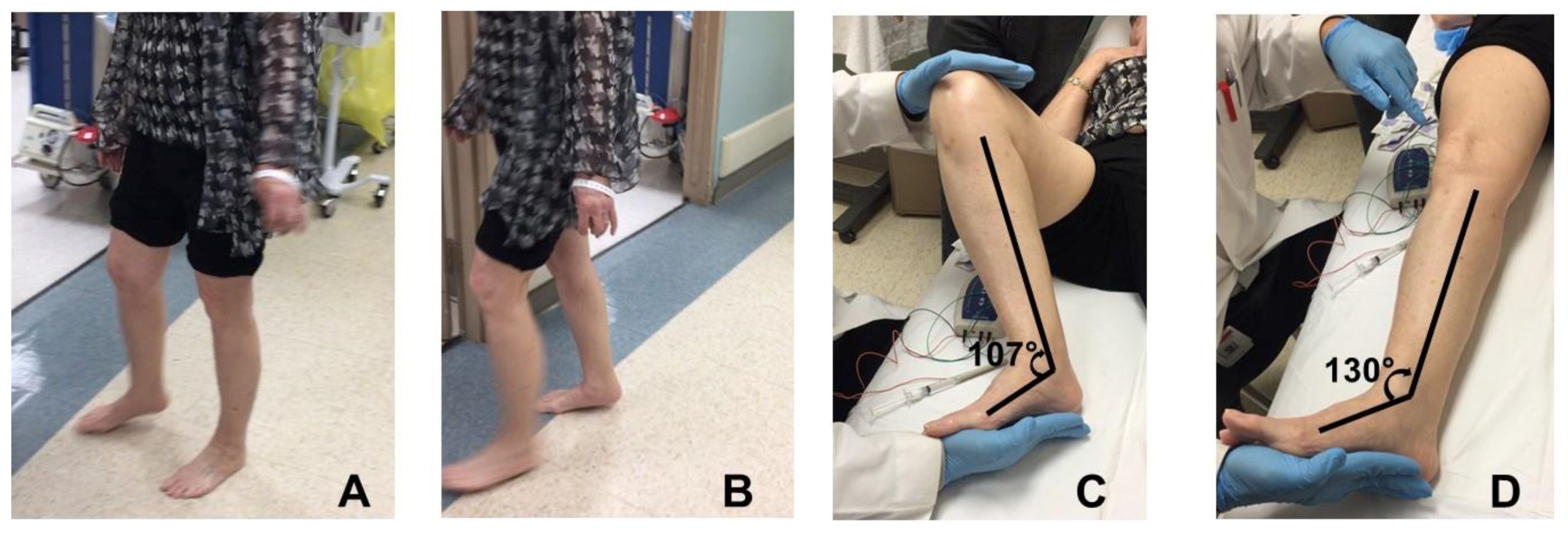 Toxins 12 00646 g002 Toxins 12 00646 g002