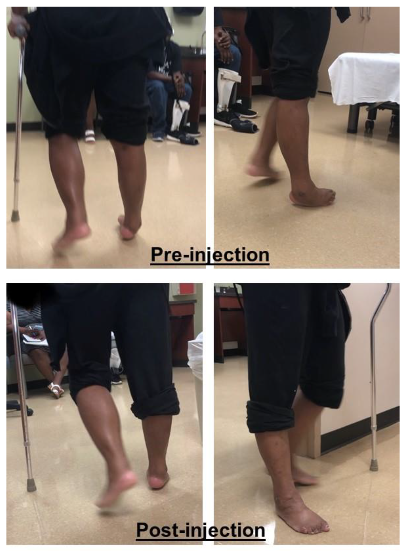 Toxins 12 00646 g003 Toxins 12 00646 g003