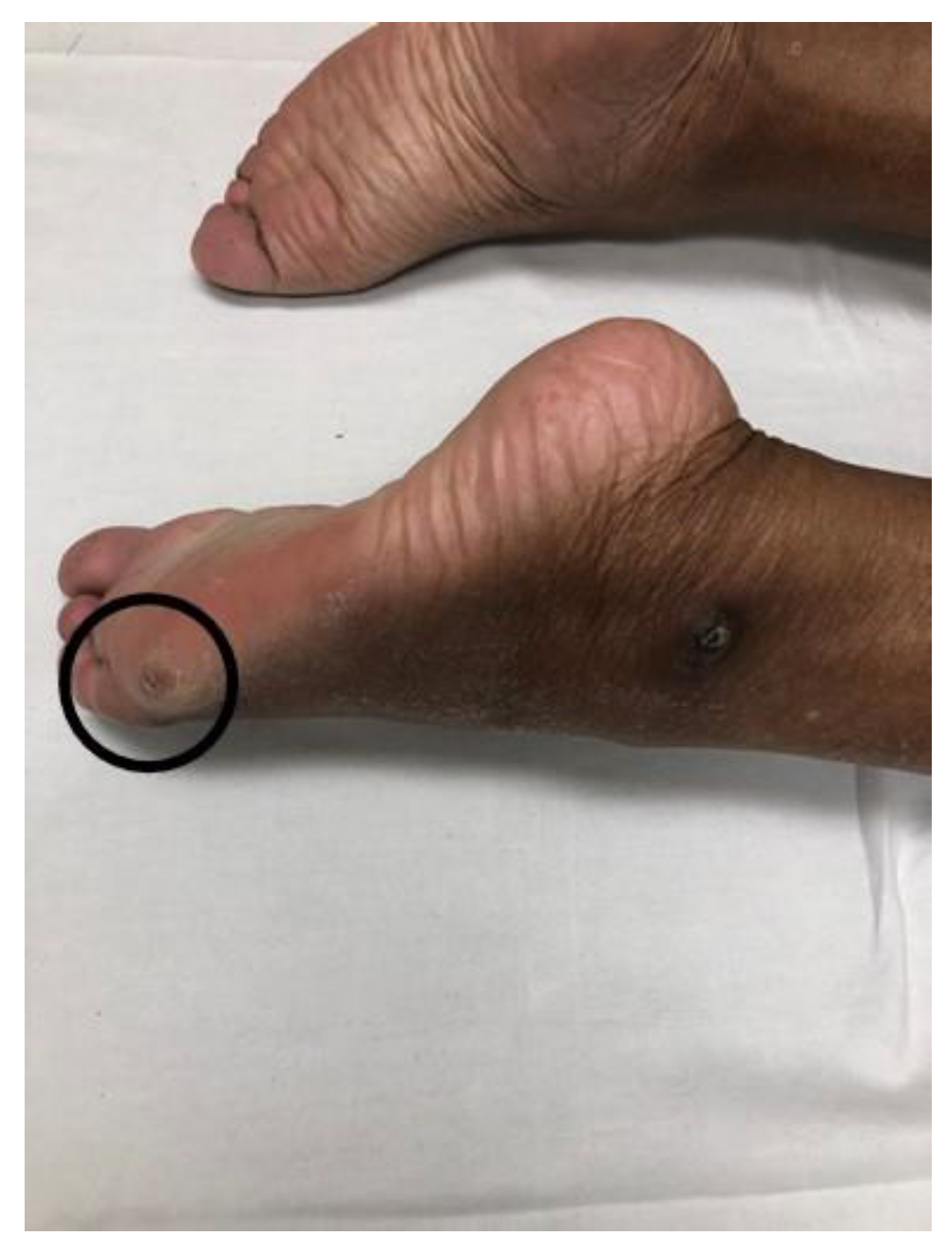 Toxins 12 00646 g004 Toxins 12 00646 g004