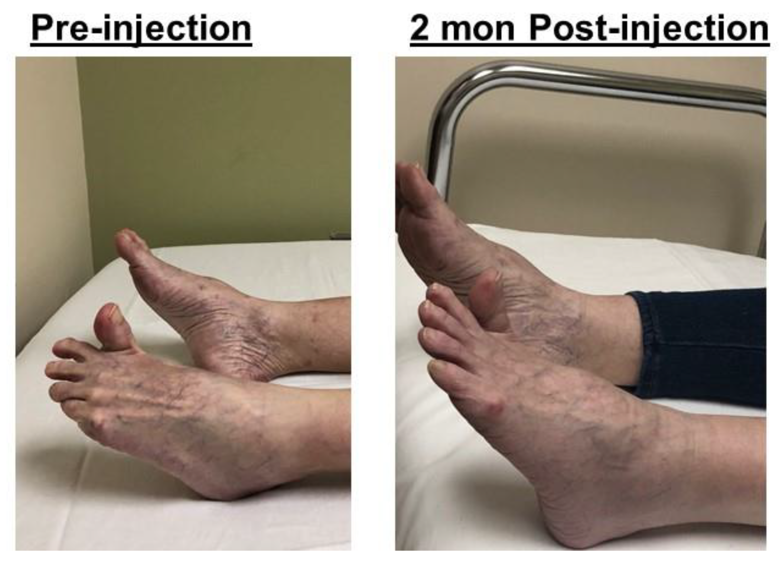 Toxins 12 00646 g006 Toxins 12 00646 g006