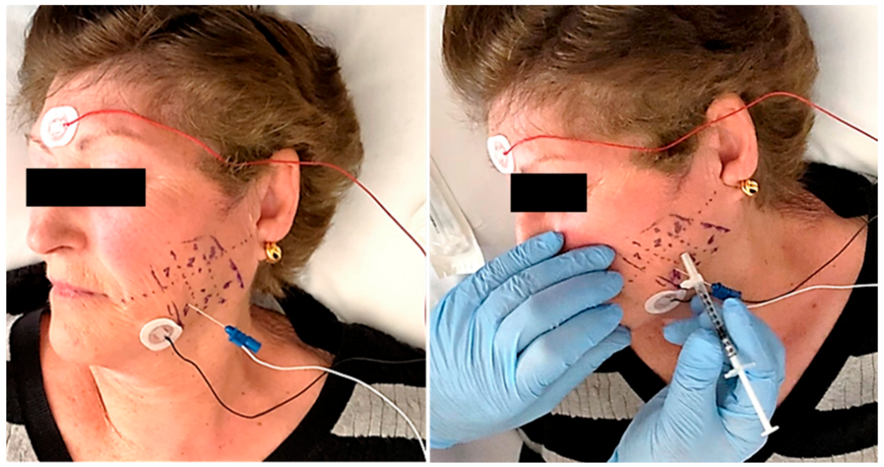 Toxins 13 00006 g002