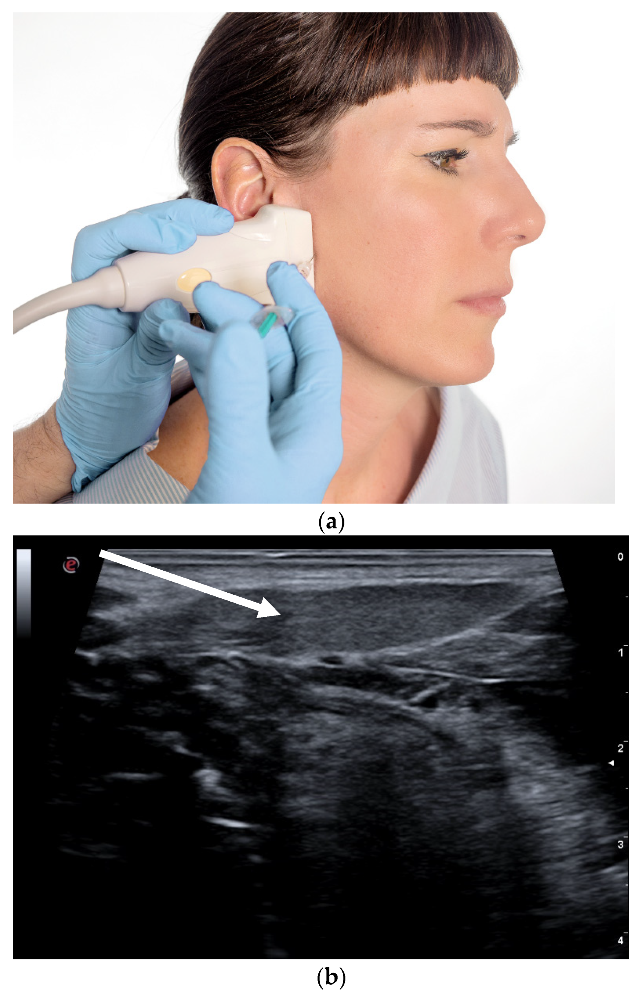Toxins 13 00087 g003