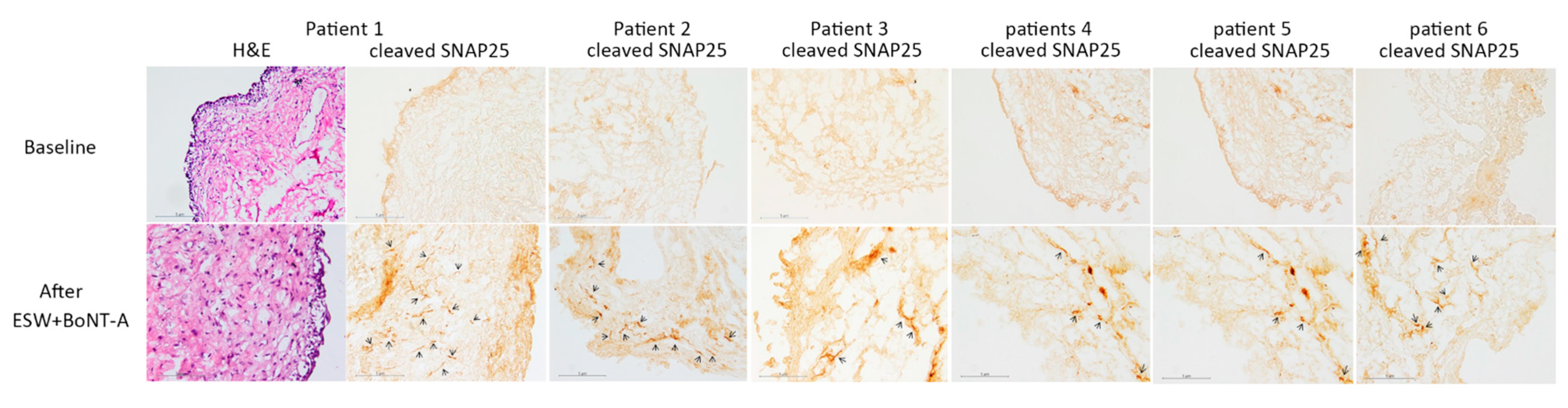Toxins 13 00359 g001 Toxins 13 00359 g001