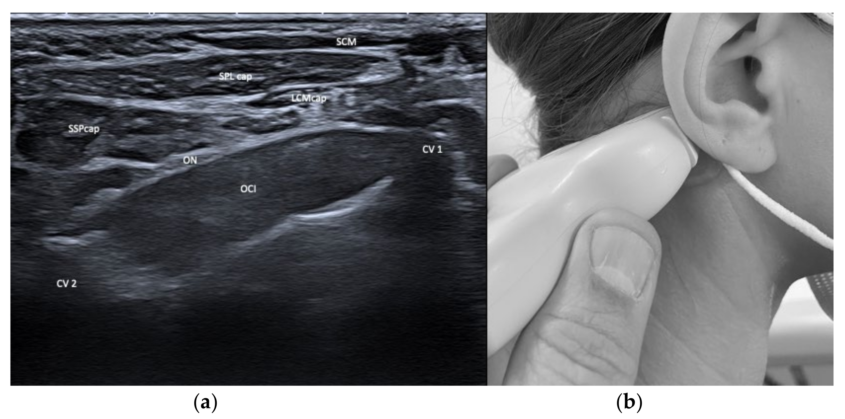 Toxins 13 00365 g002