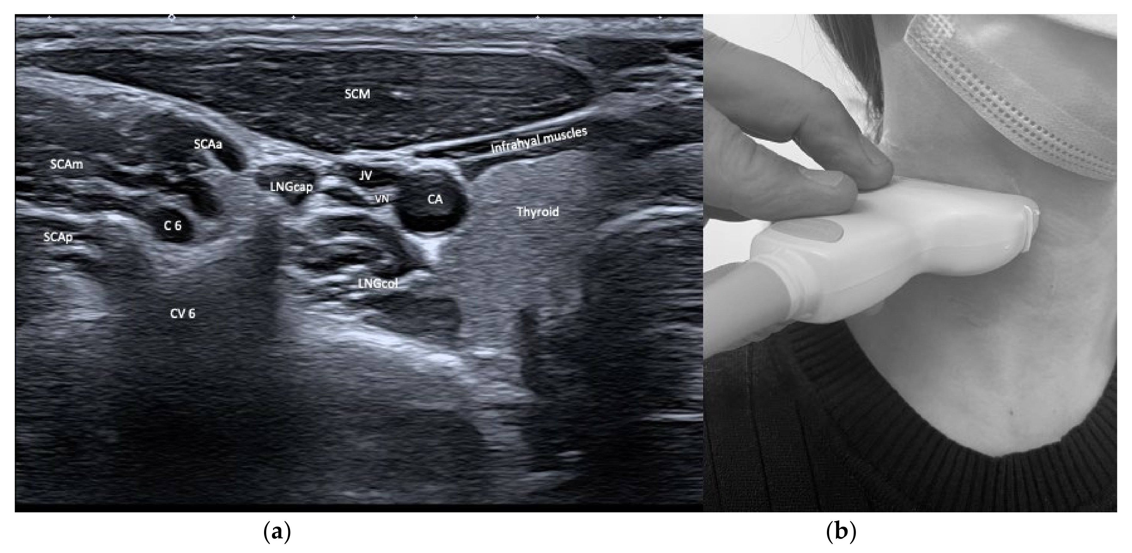 Toxins 13 00365 g003