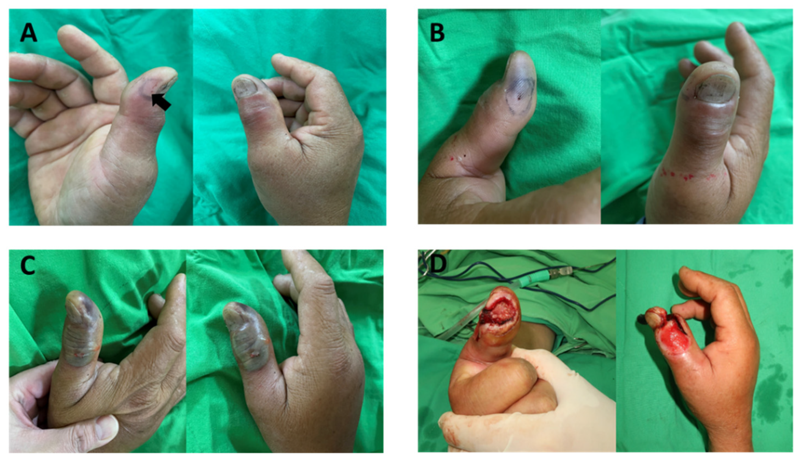 Toxins 13 00619 g001 550