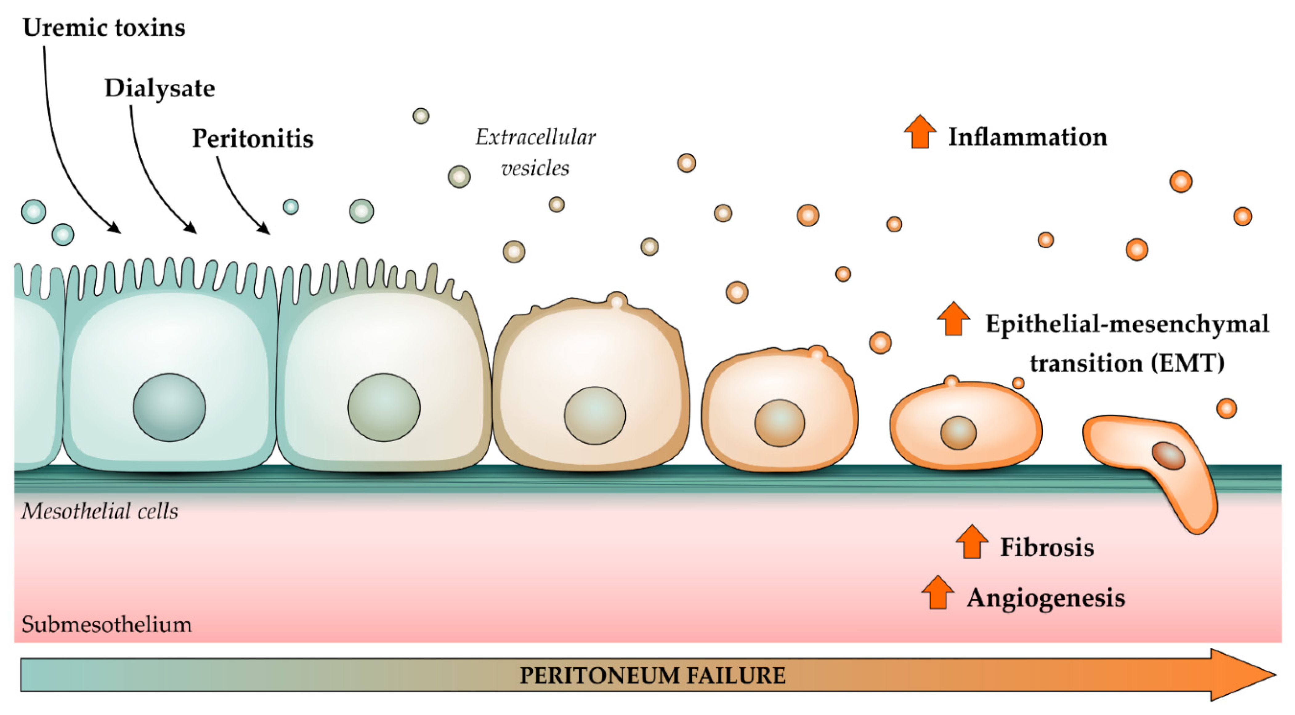 prostate fibrosis mi ez az