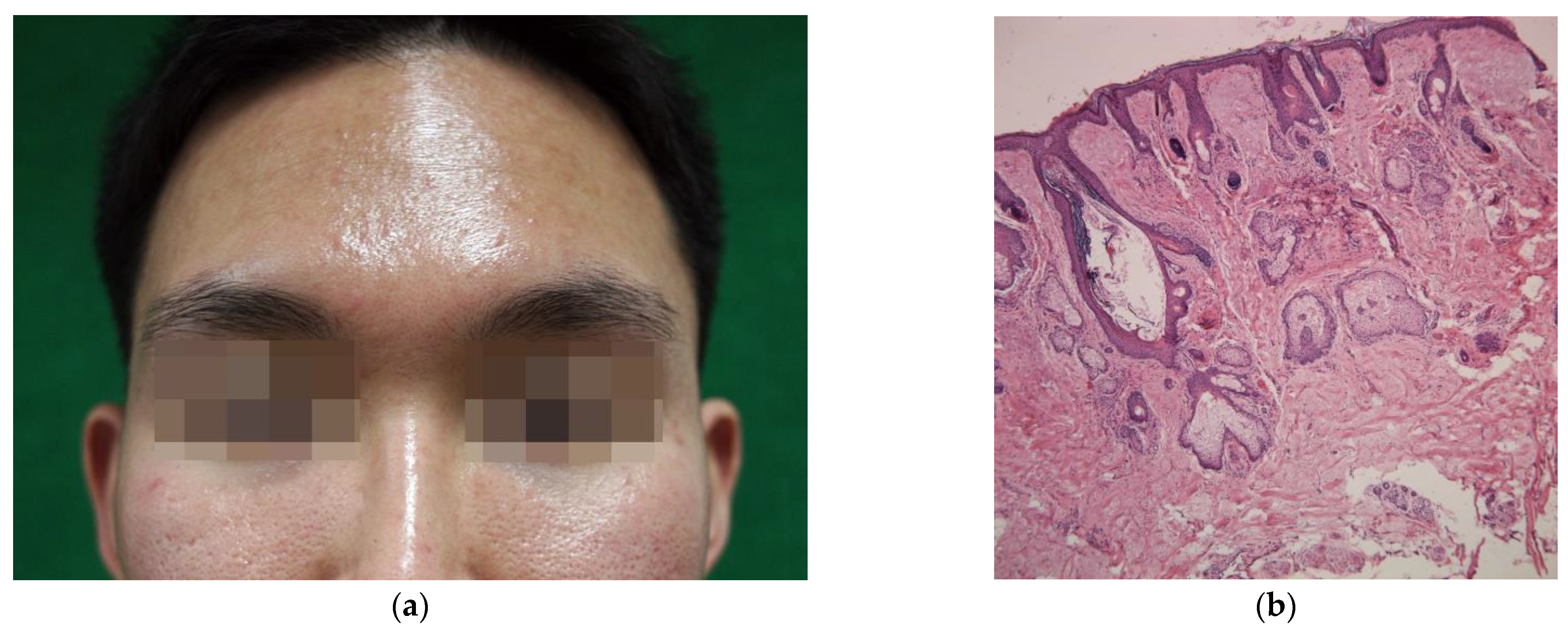 Toxins 13 00817 g001