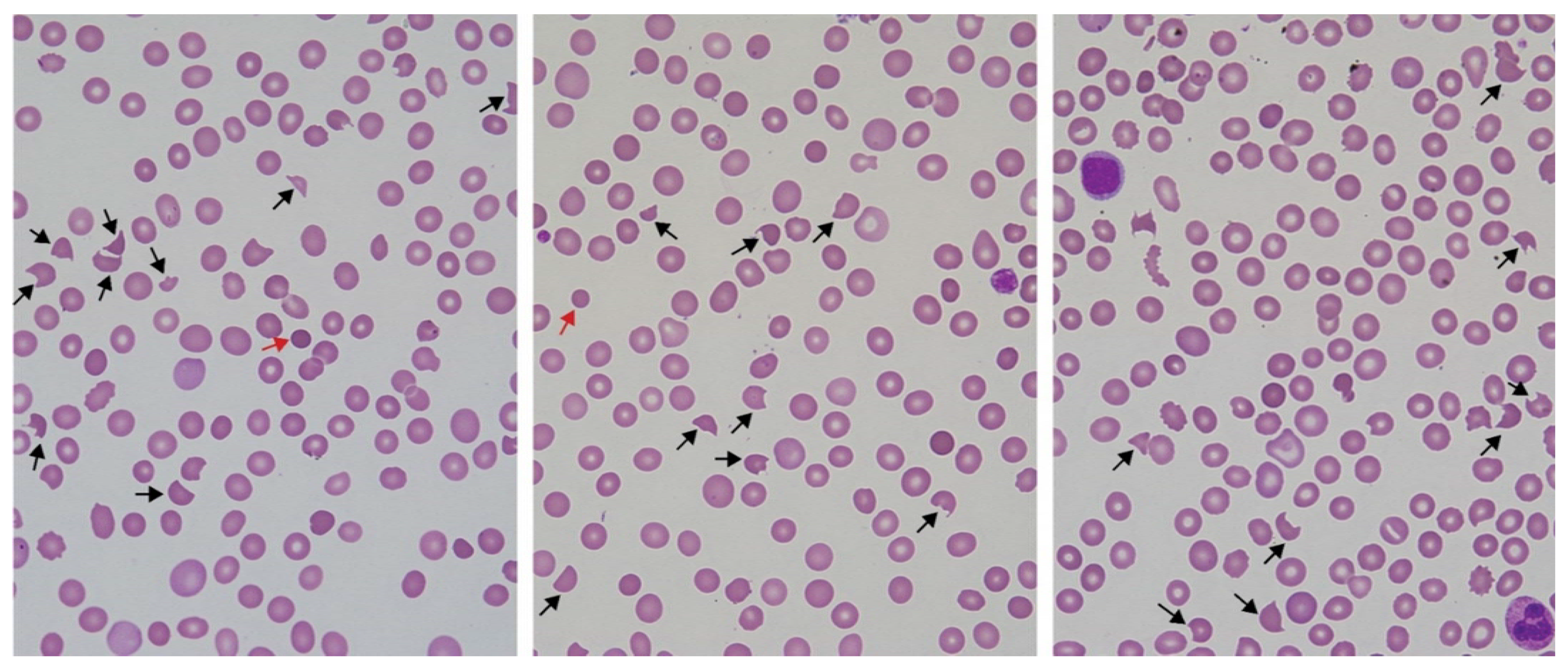 Toxins 14 00057 g002