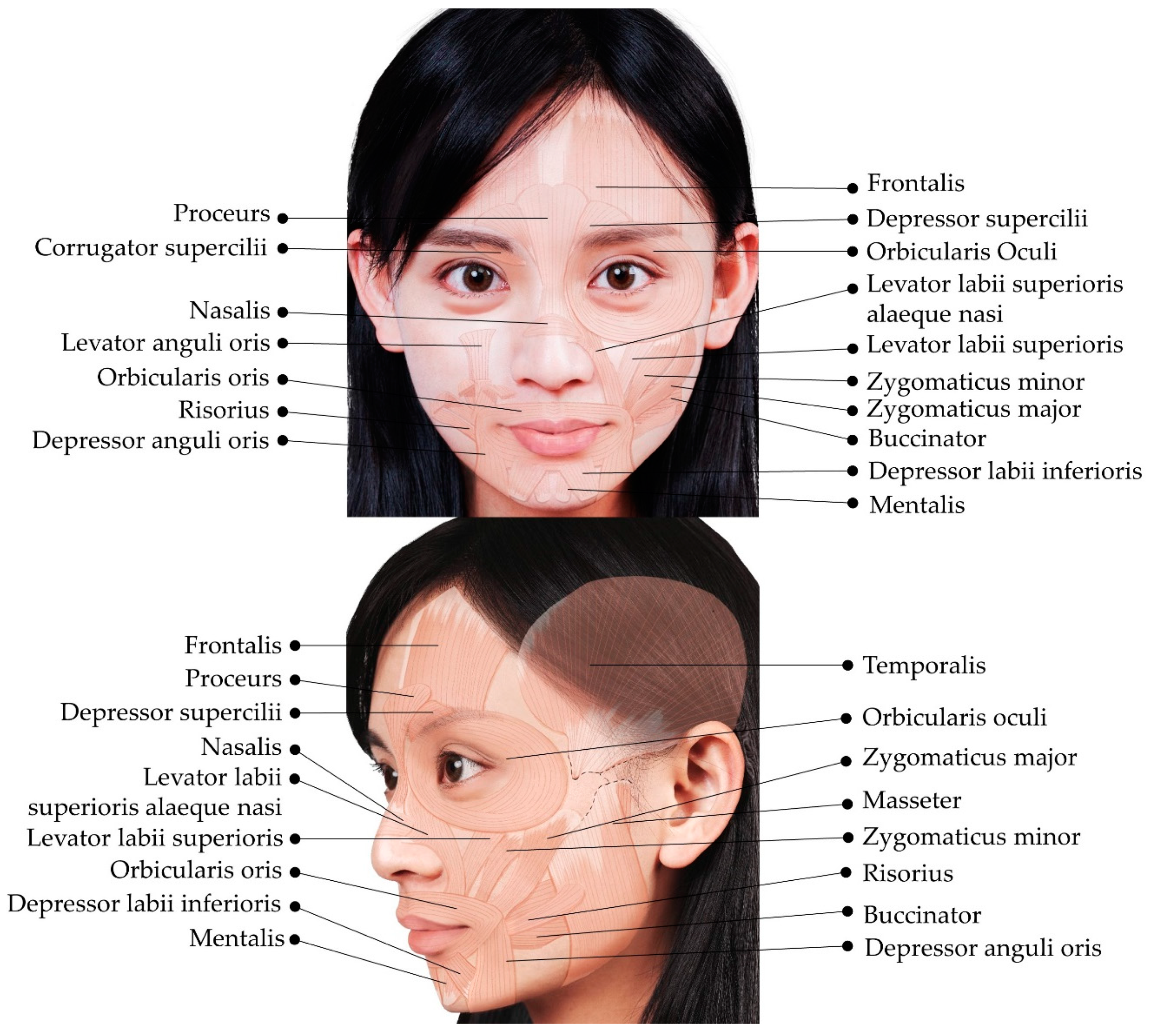Toxins | Free Full-Text | Ultrasound Imaging of the Facial Muscles and  Relevance with Botulinum Toxin Injections: A Pictorial Essay and Narrative  Review