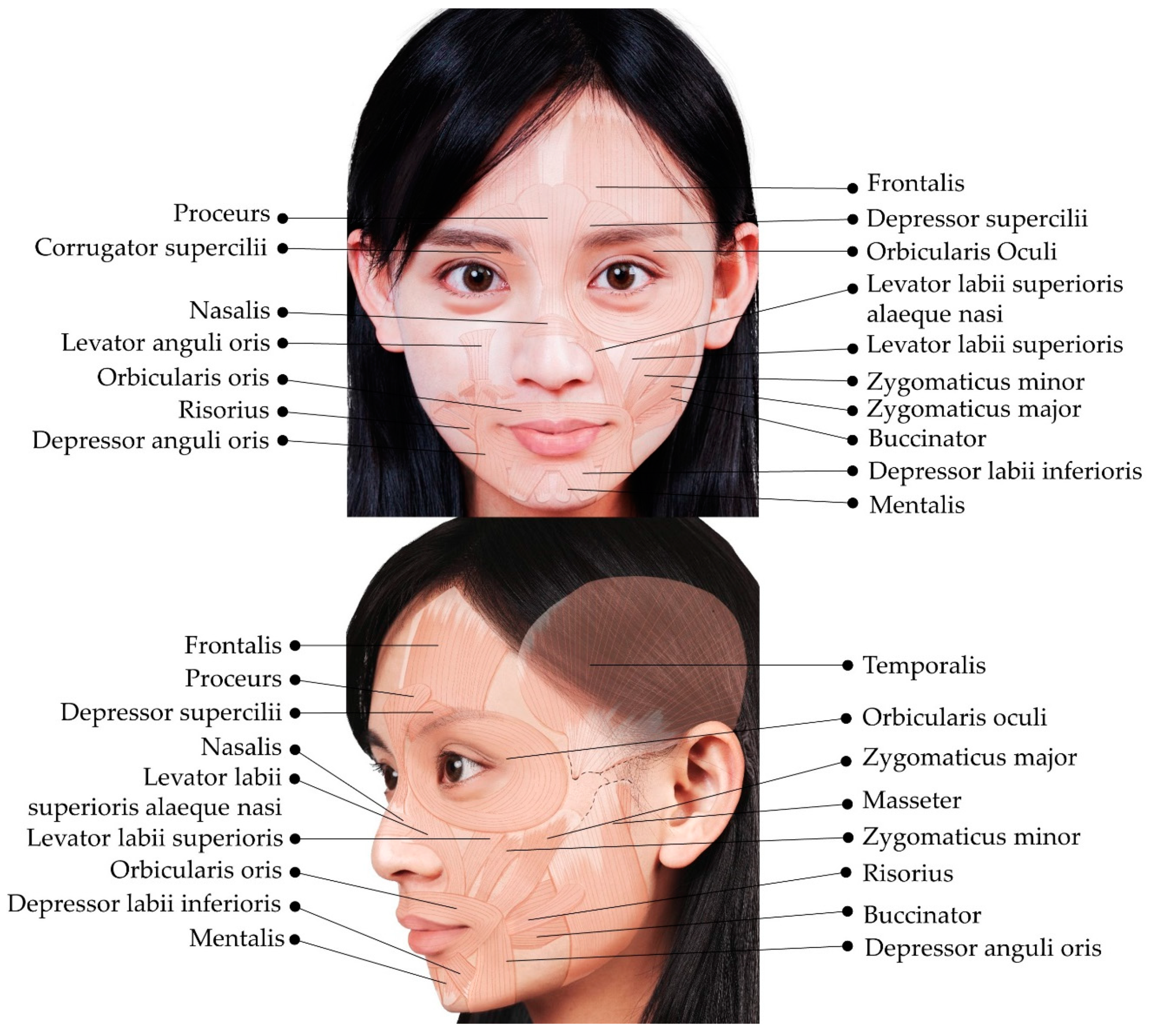 Toxins Free Full-Text Ultrasound Imaging of the Facial Muscles and Relevance with Botulinum Toxin Injections A Pictorial Essay and Narrative Review image