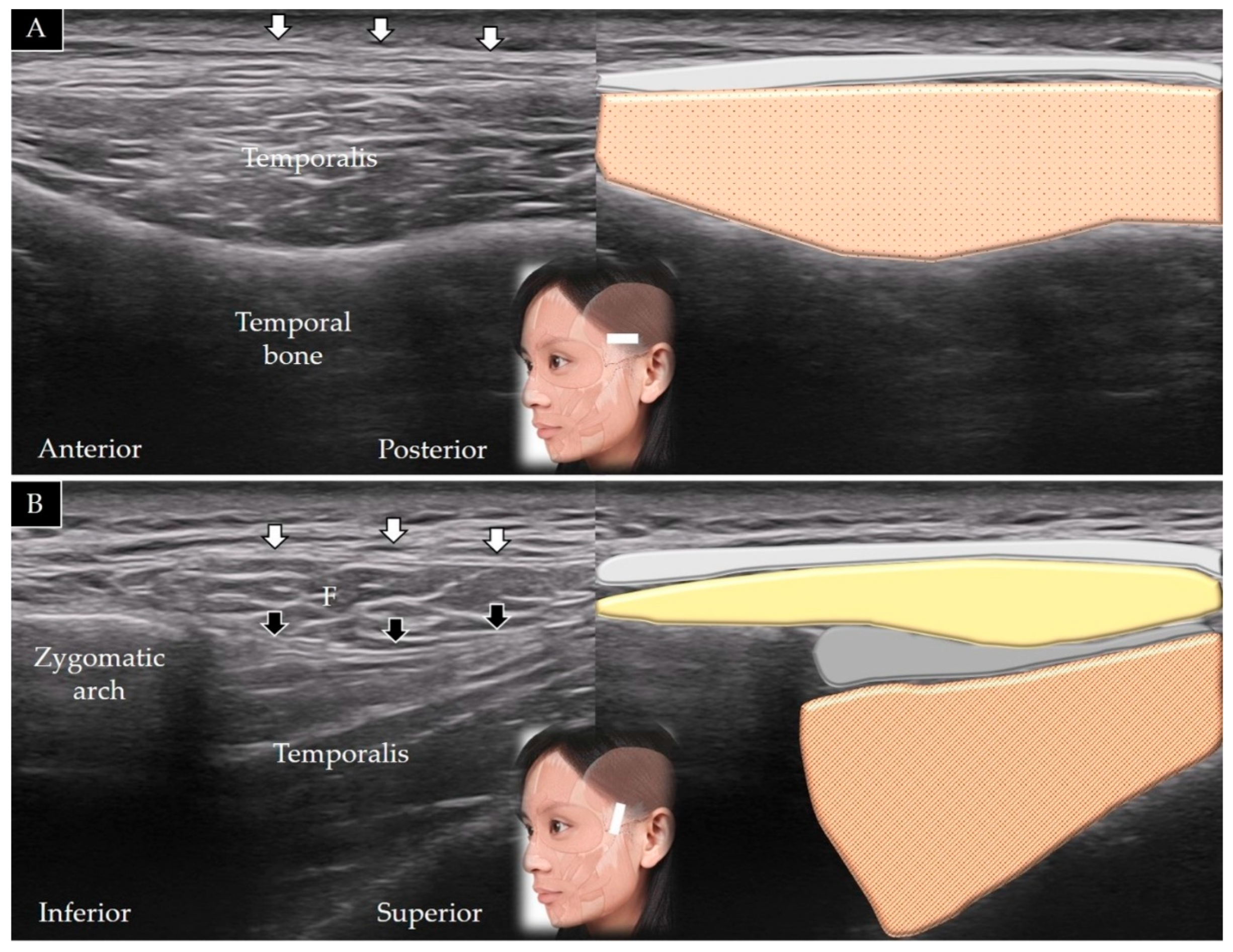 Toxins 14 00101 g003
