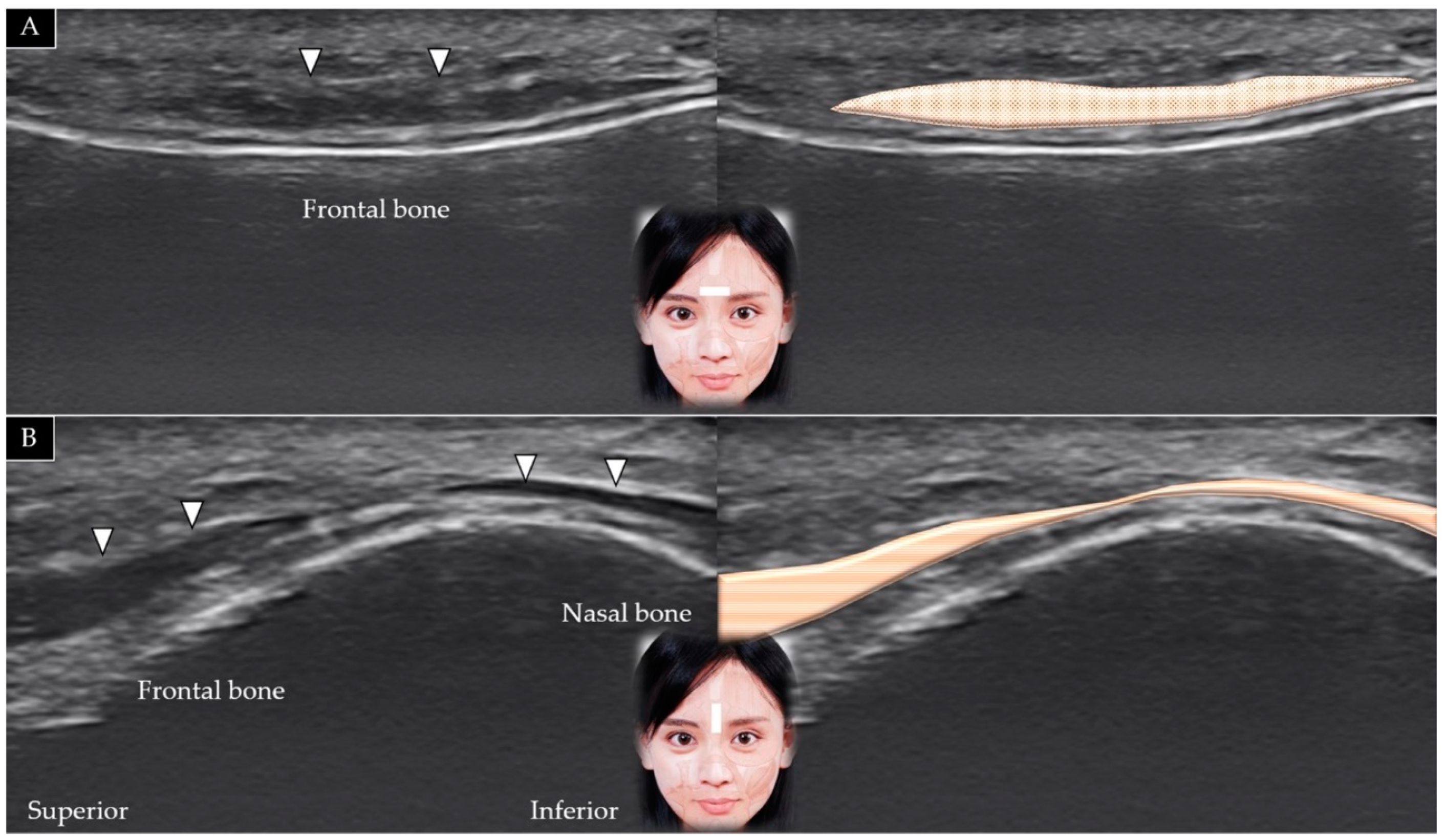 Toxins 14 00101 g004