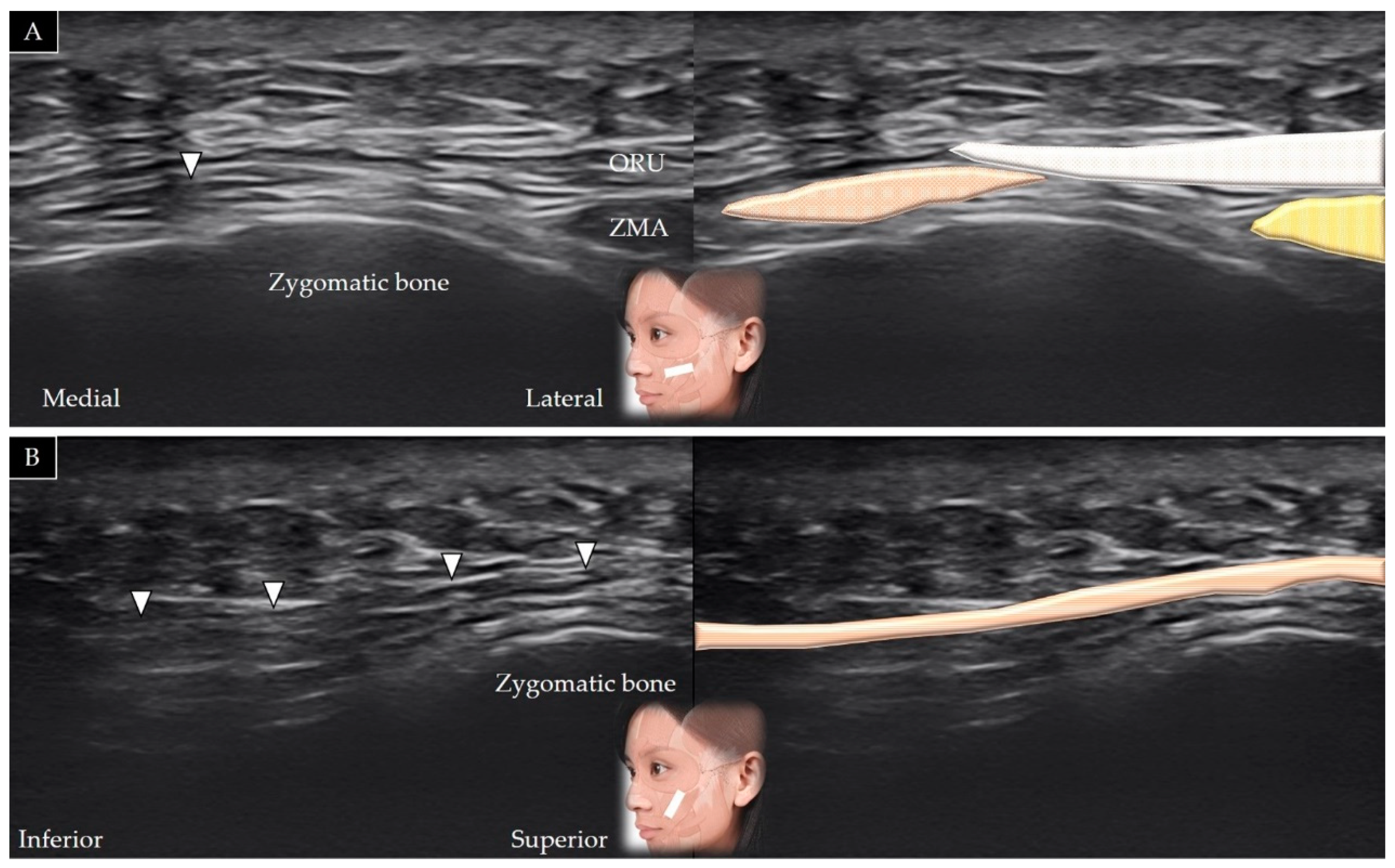 Toxins 14 00101 g011