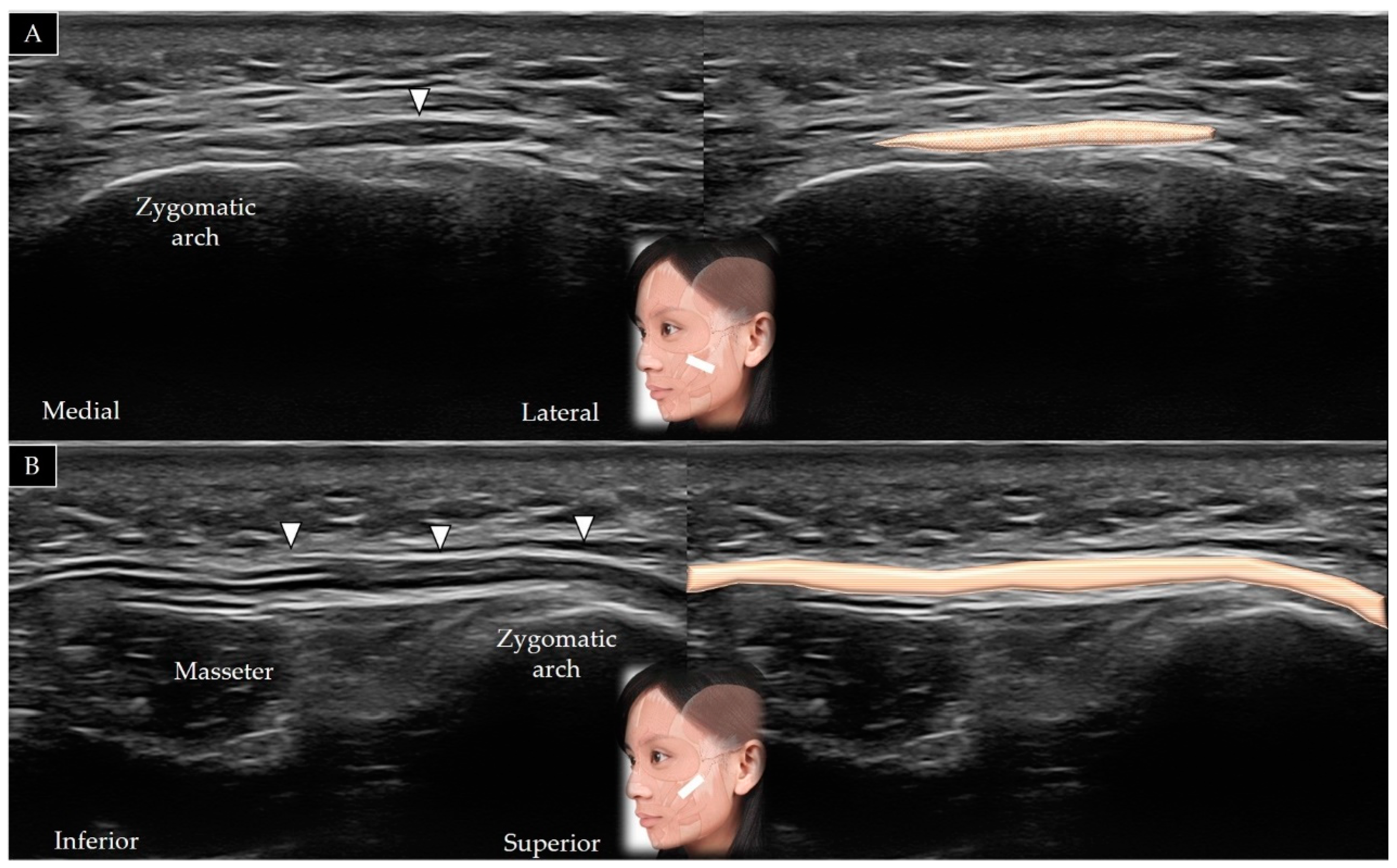 Toxins 14 00101 g012