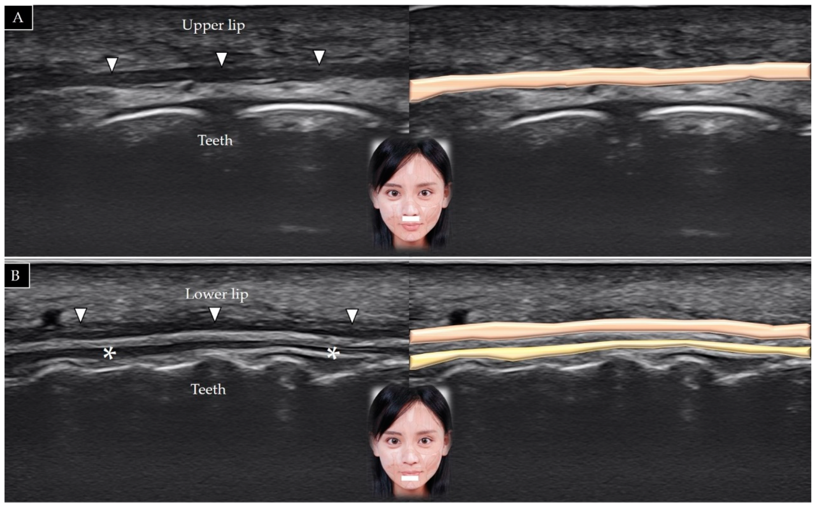 Toxins 14 00101 g014