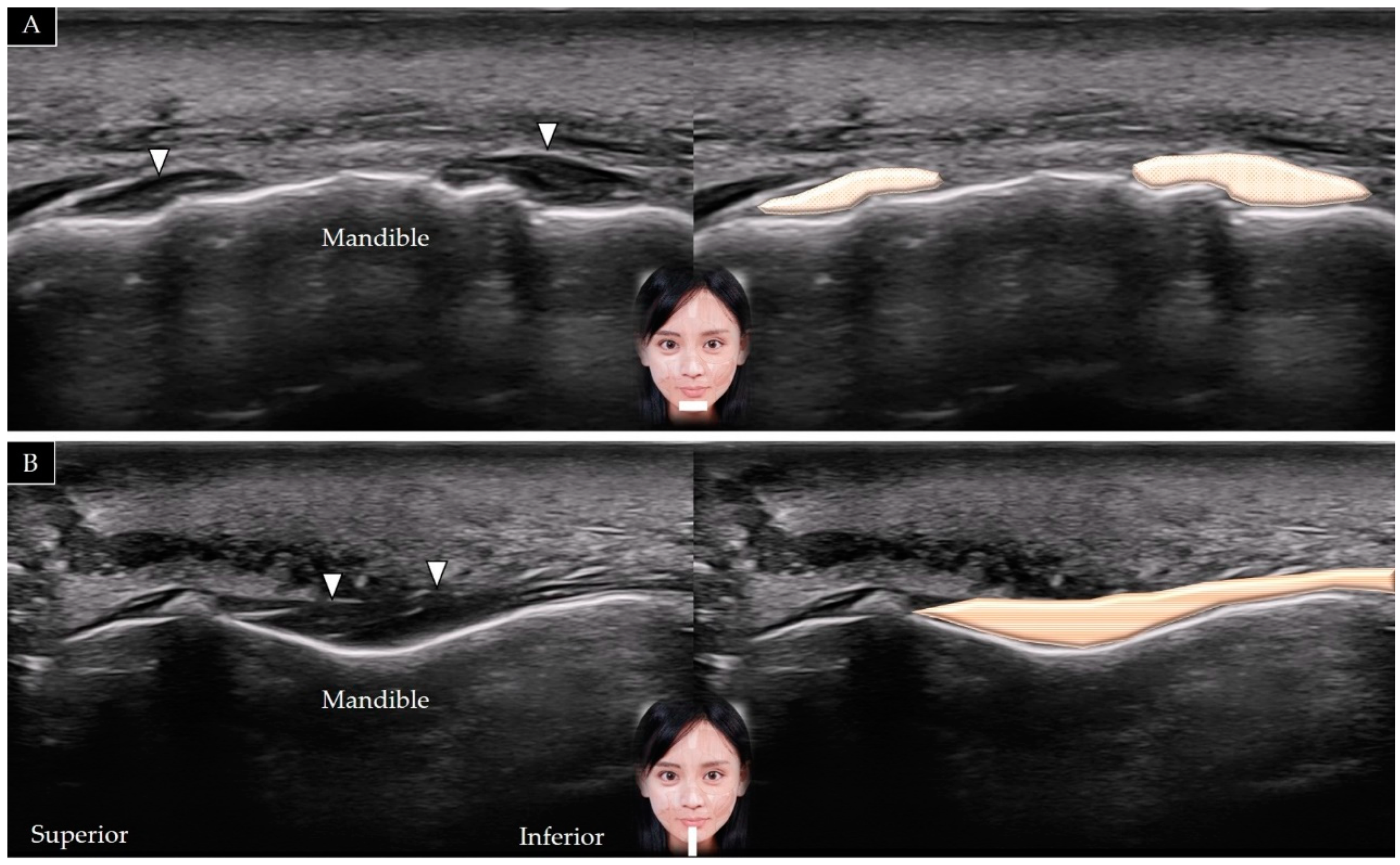 Toxins 14 00101 g016