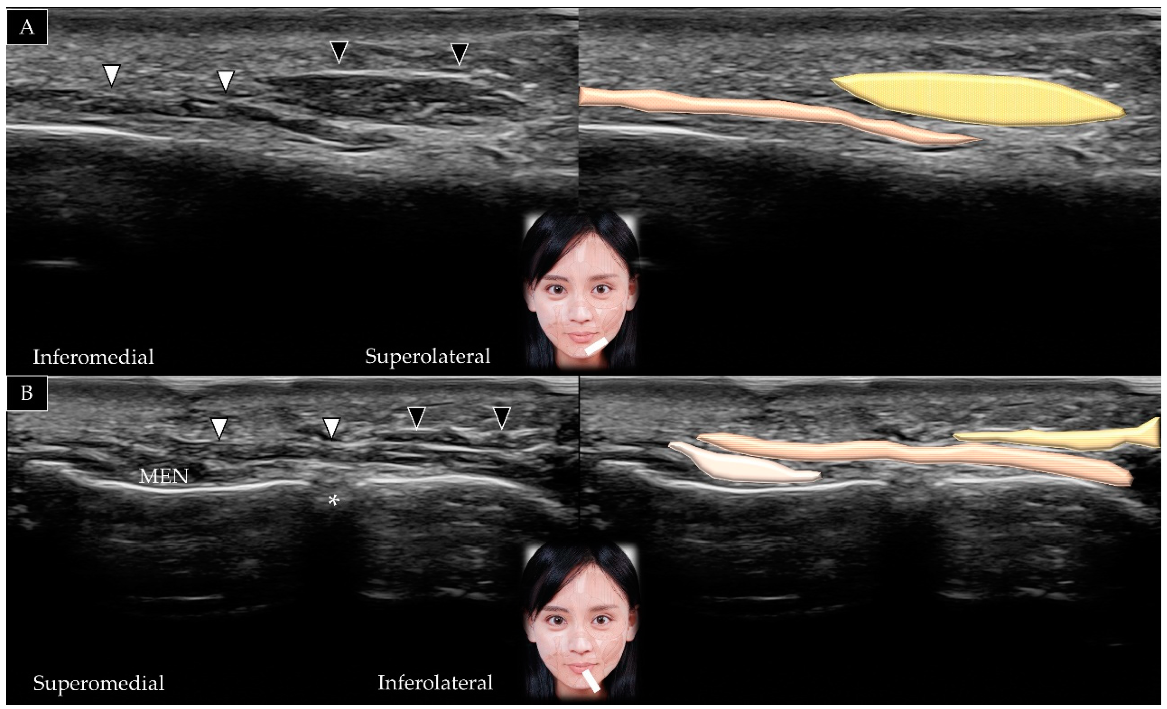 Toxins 14 00101 g017