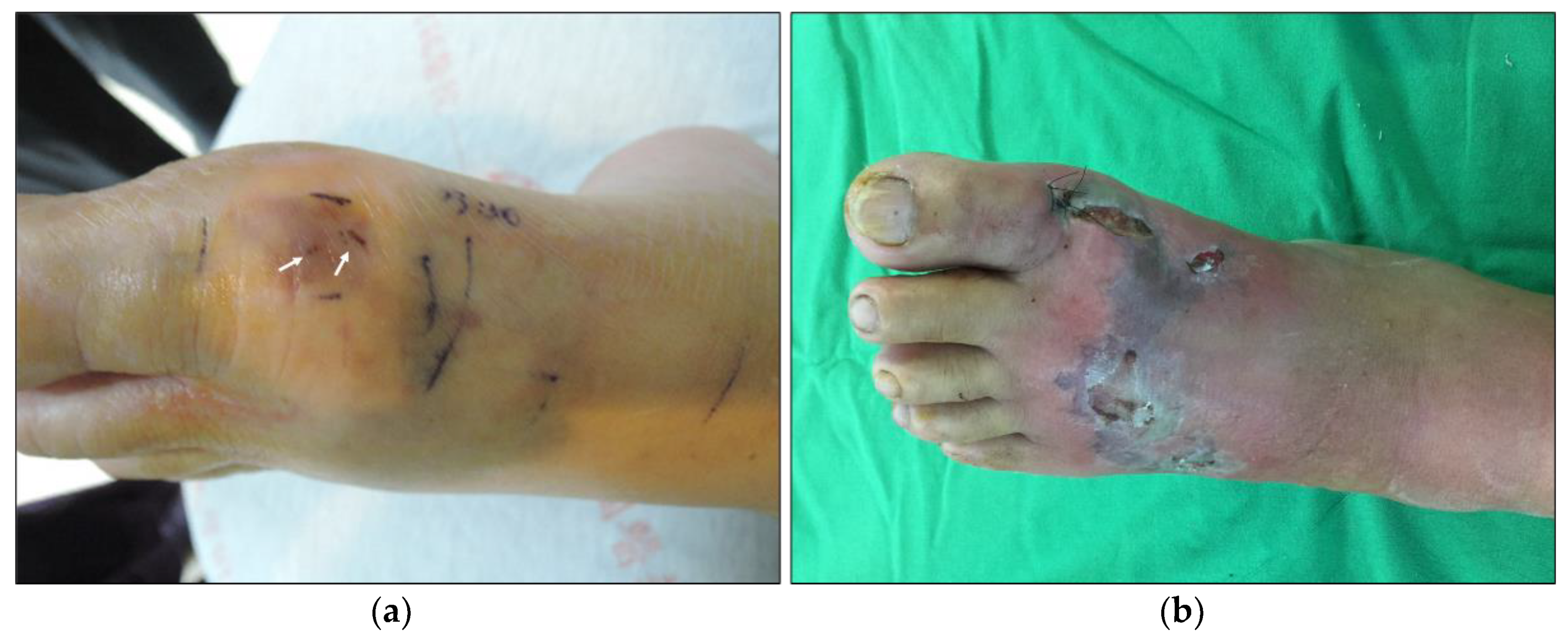 Toxins 14 00122 g001 550