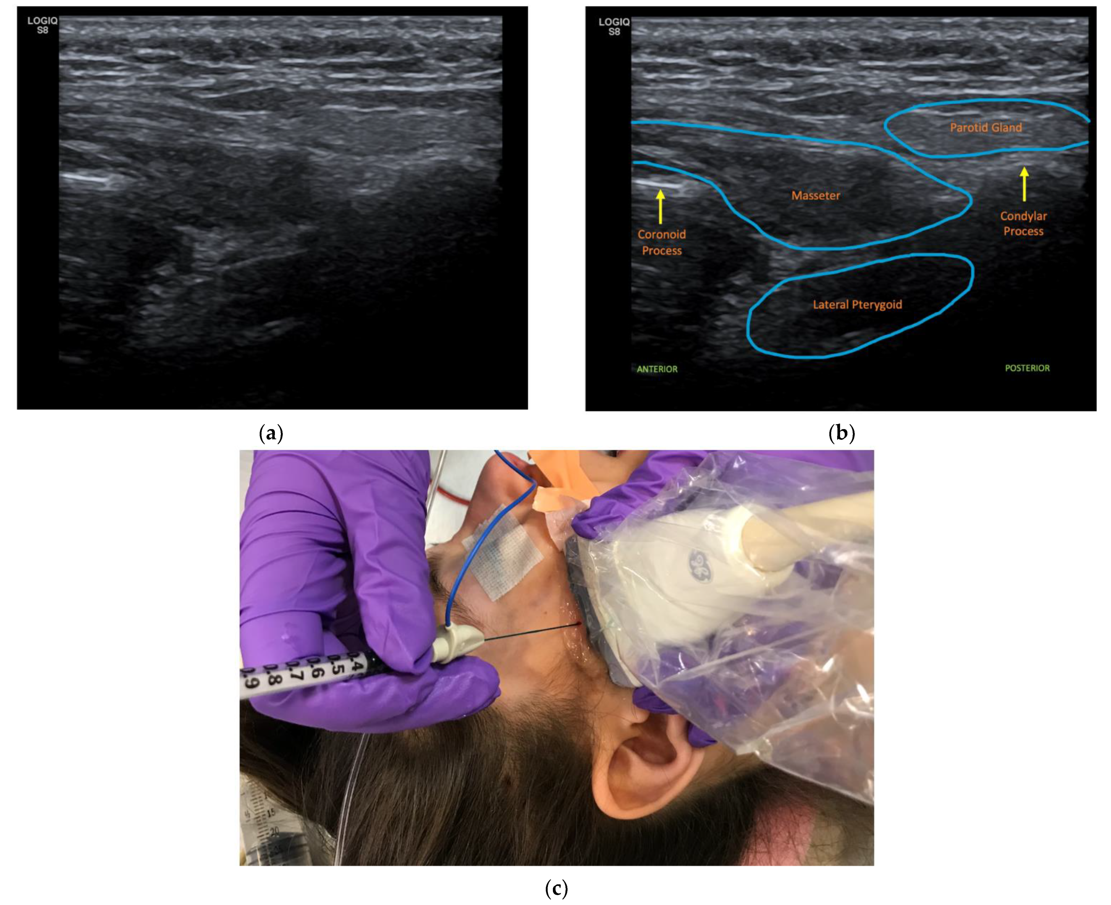 Toxins 14 00158 g001