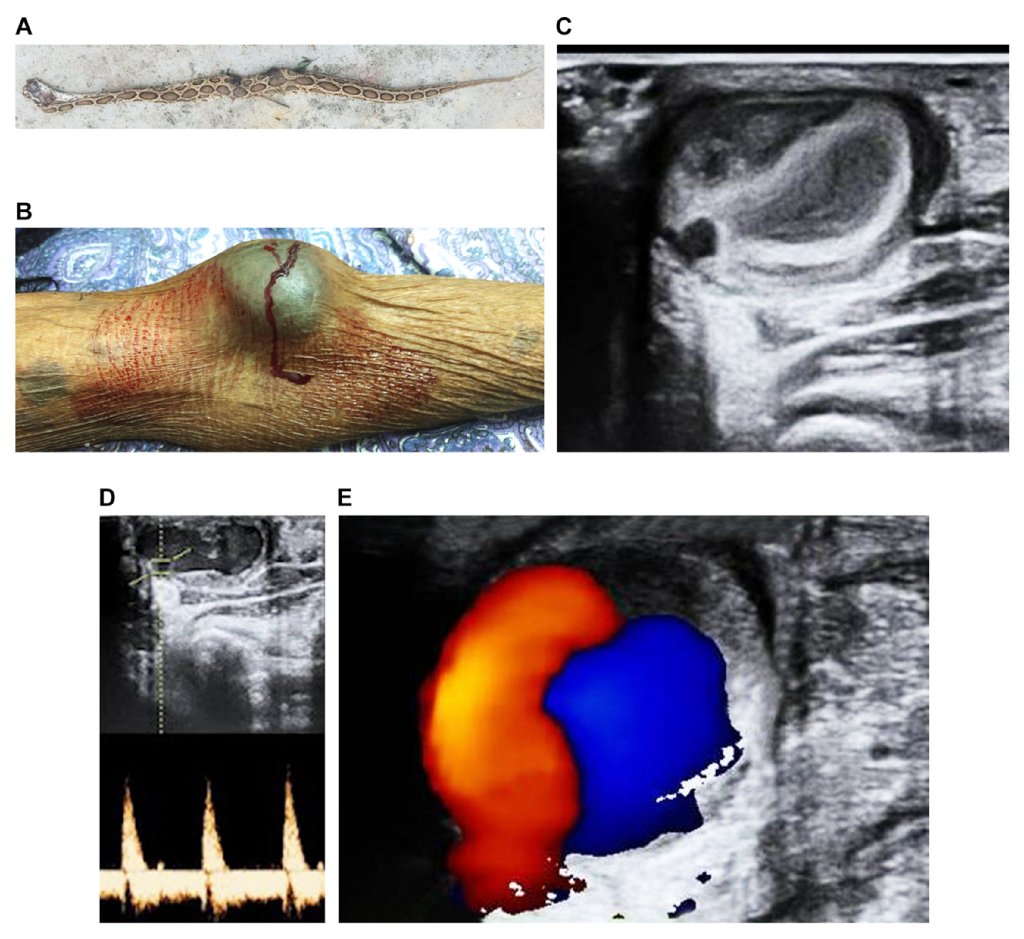 Toxins 14 00260 g001 Toxins 14 00260 g001