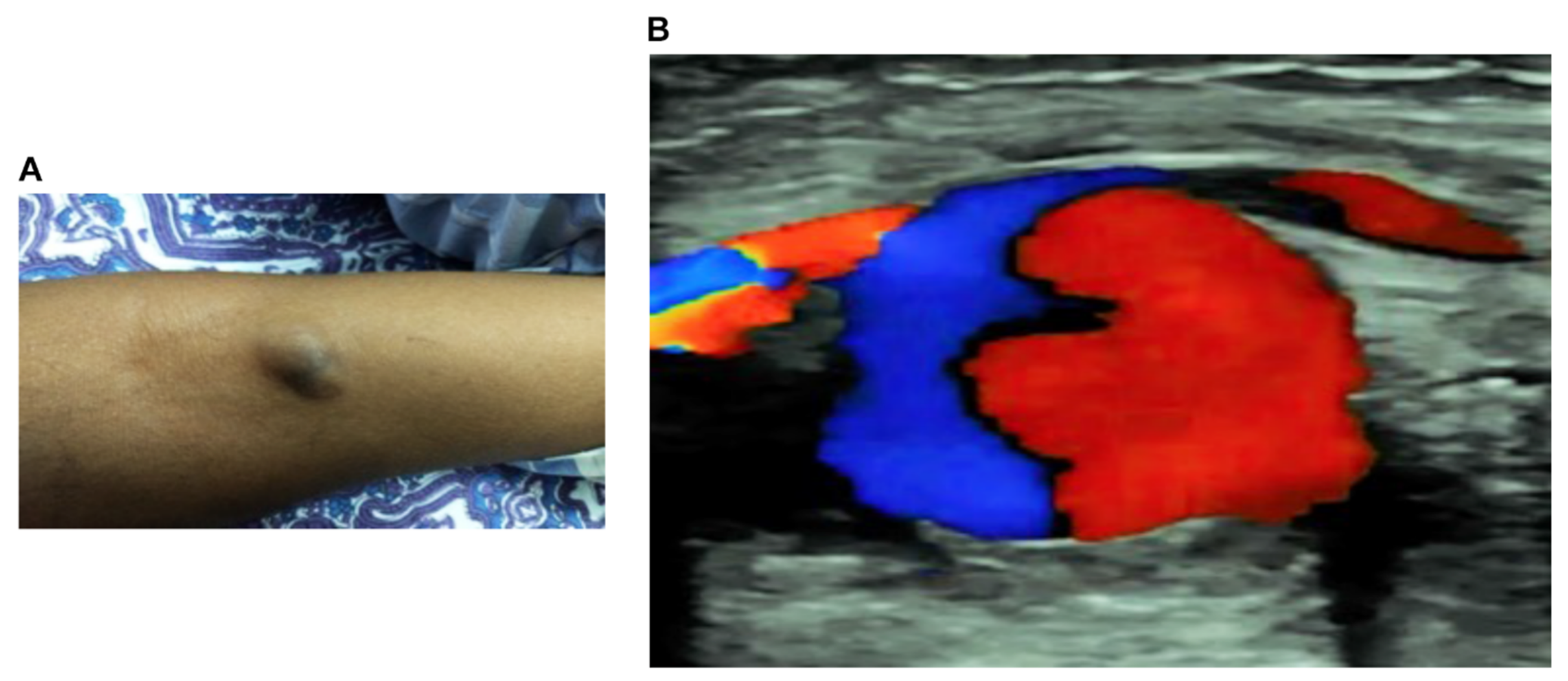 Toxins 14 00260 g002 Toxins 14 00260 g002