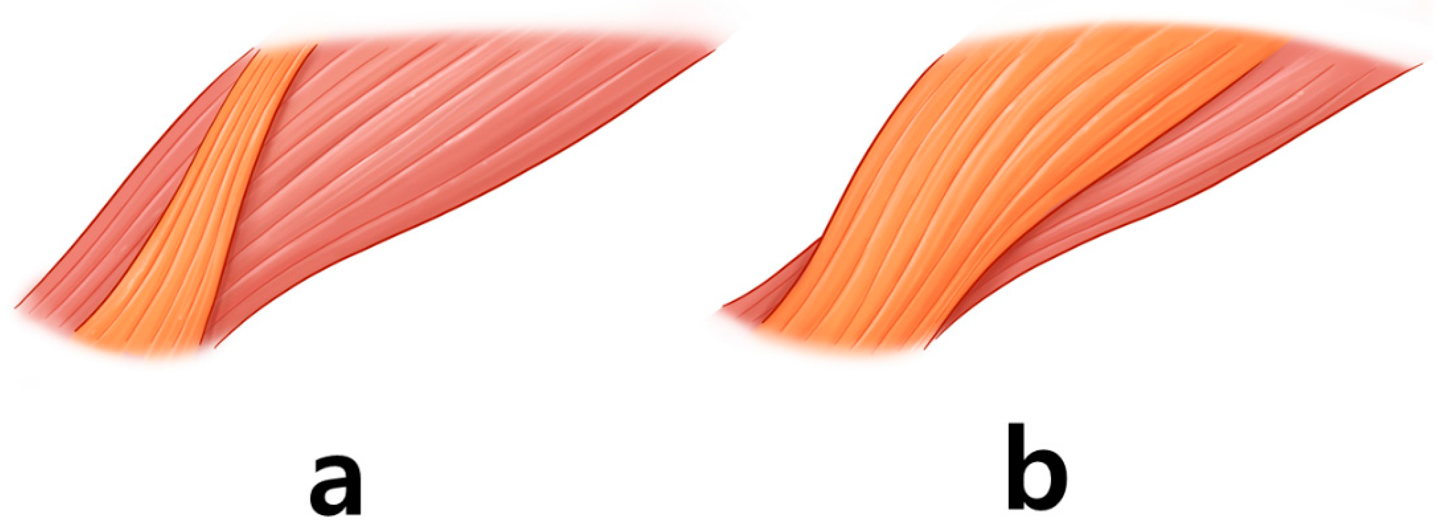 Toxins 14 00268 g004 550