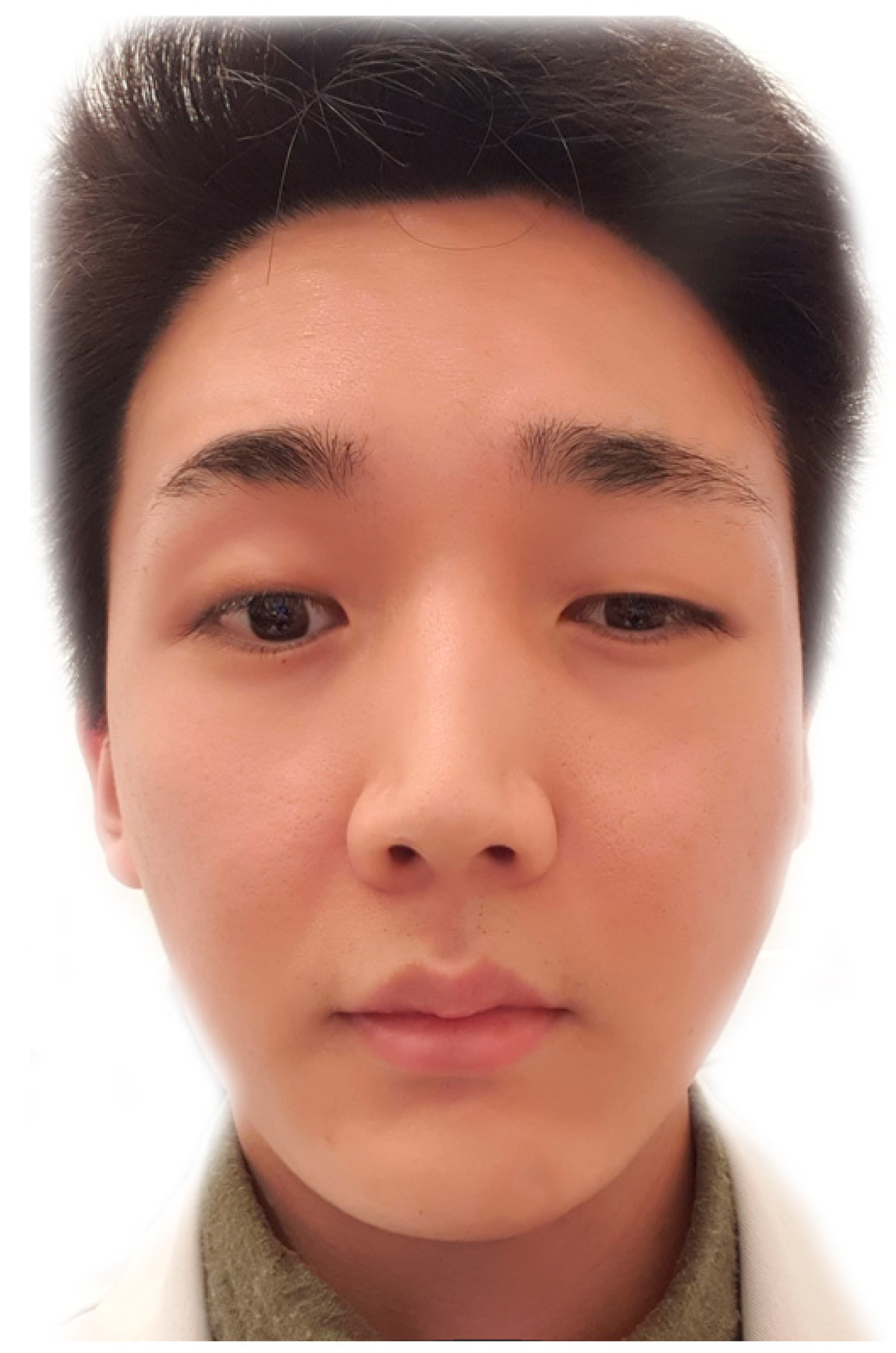 Toxins 14 00268 g006 550