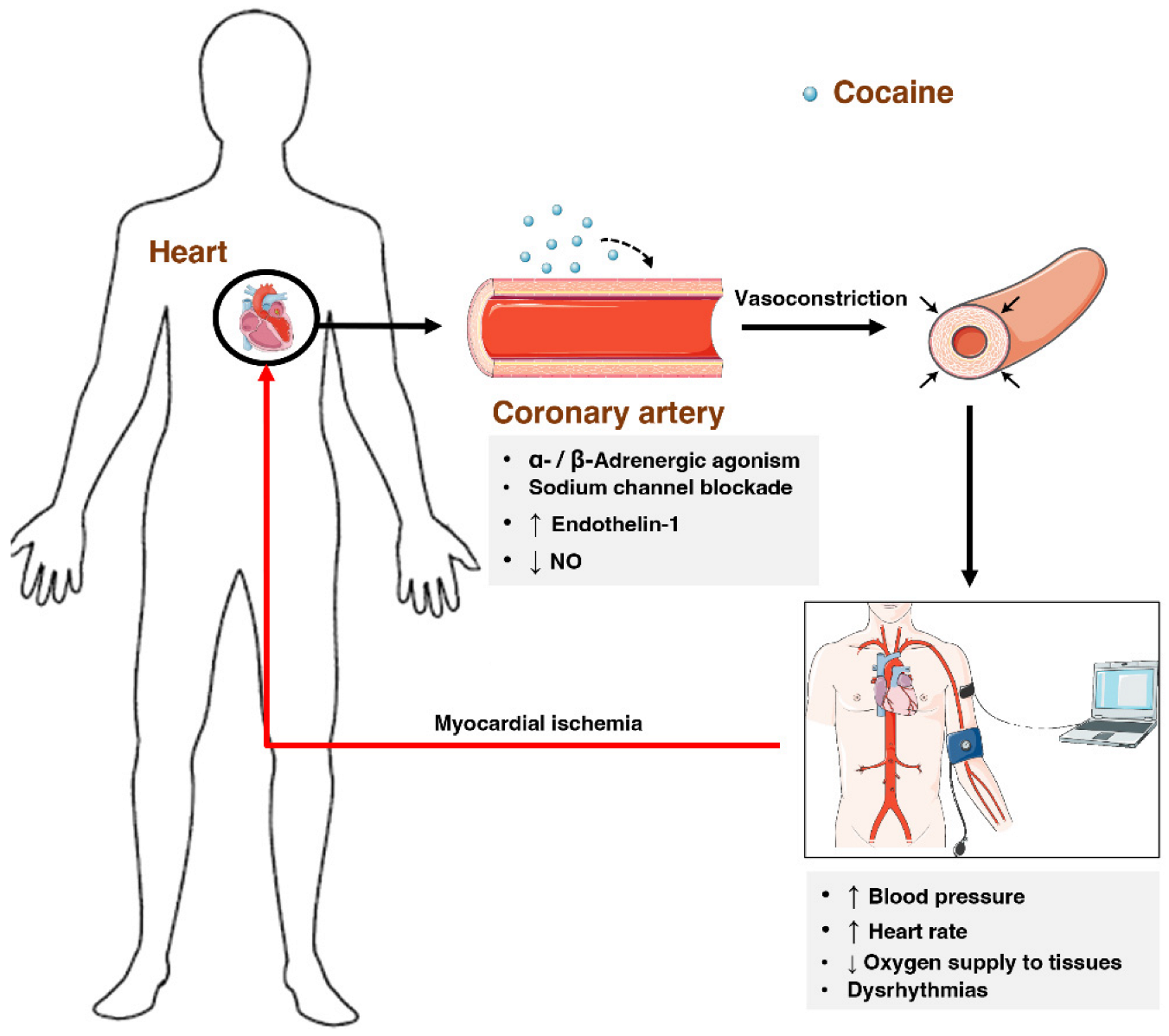 Why does cocaine make you poop? Digestive effects, risks, and more