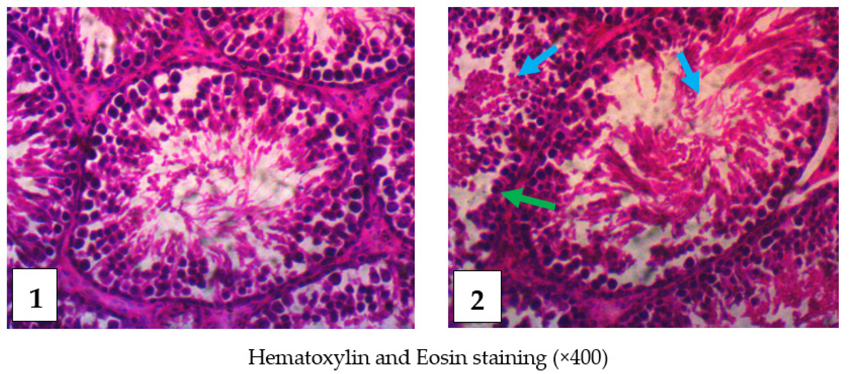 Toxins 14 00378 g006