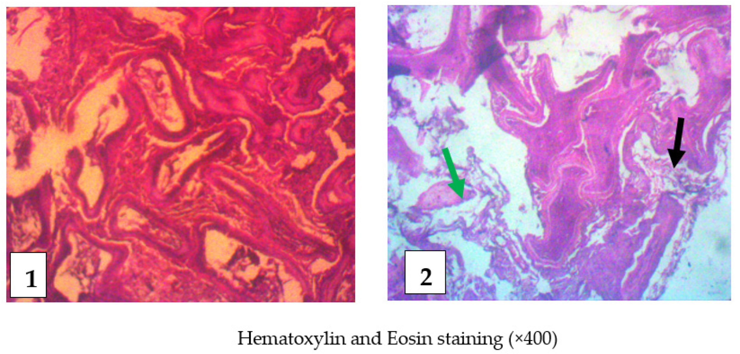 Toxins 14 00378 g007