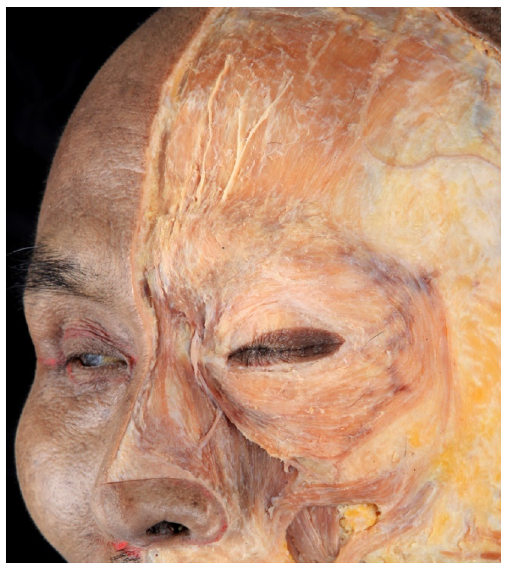 Toxins 14 00462 g004