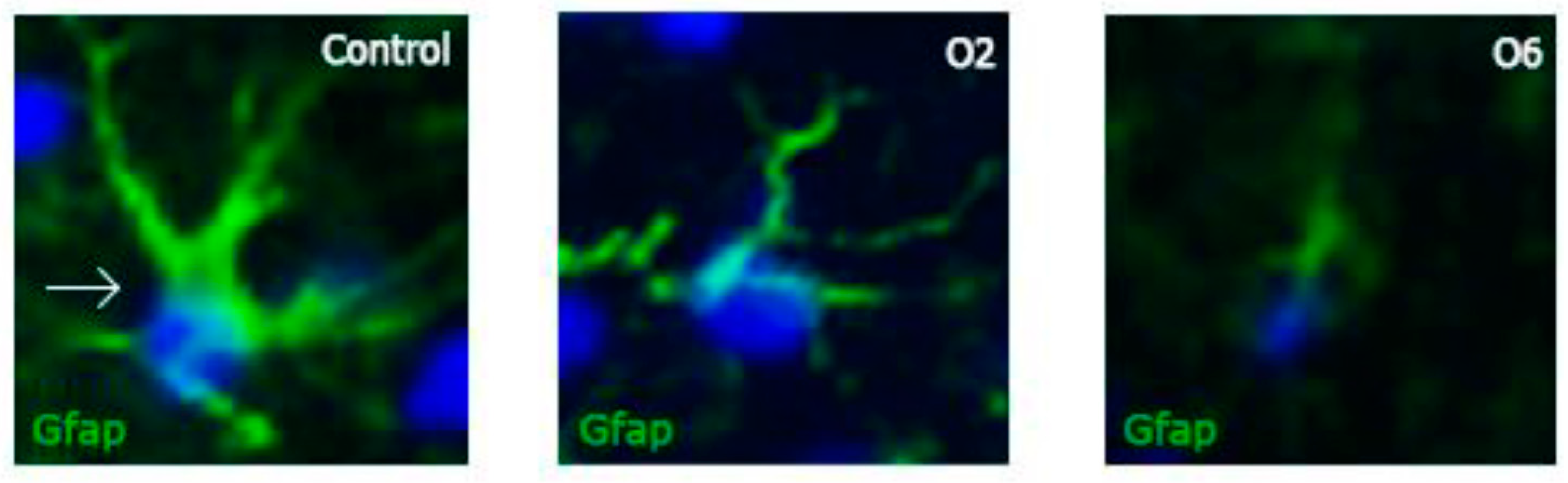 Toxins 14 00624 g003 550