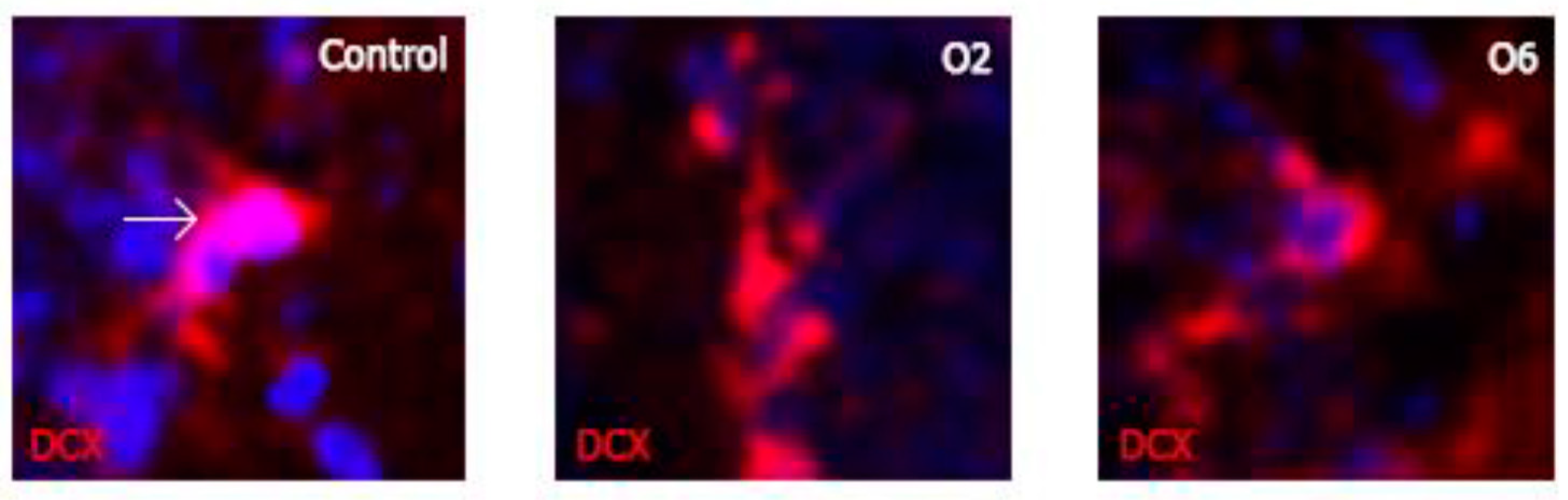 Toxins 14 00624 g006 550