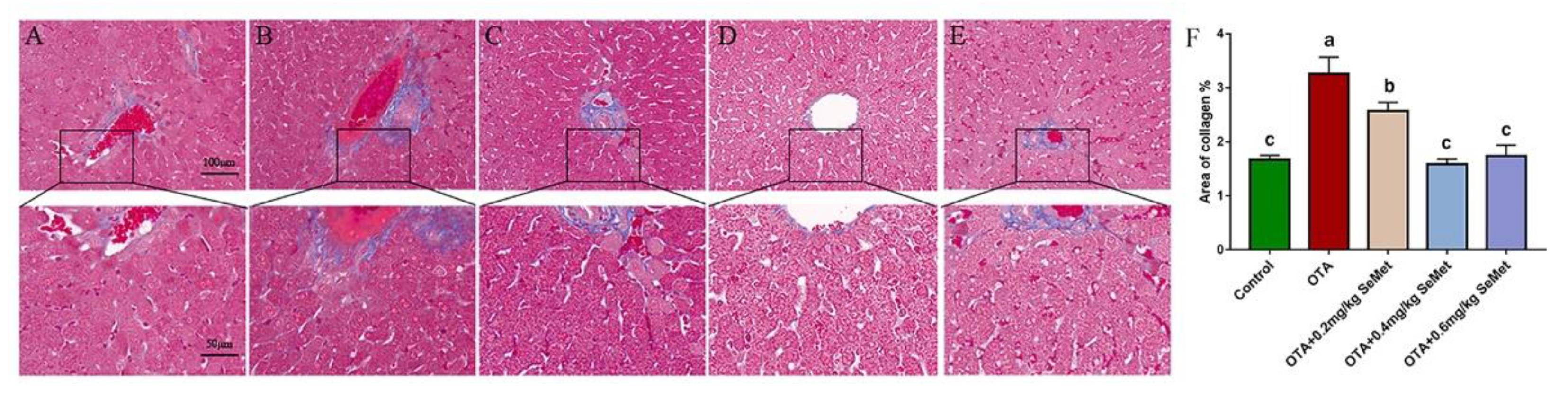 Toxins 14 00628 g004 550