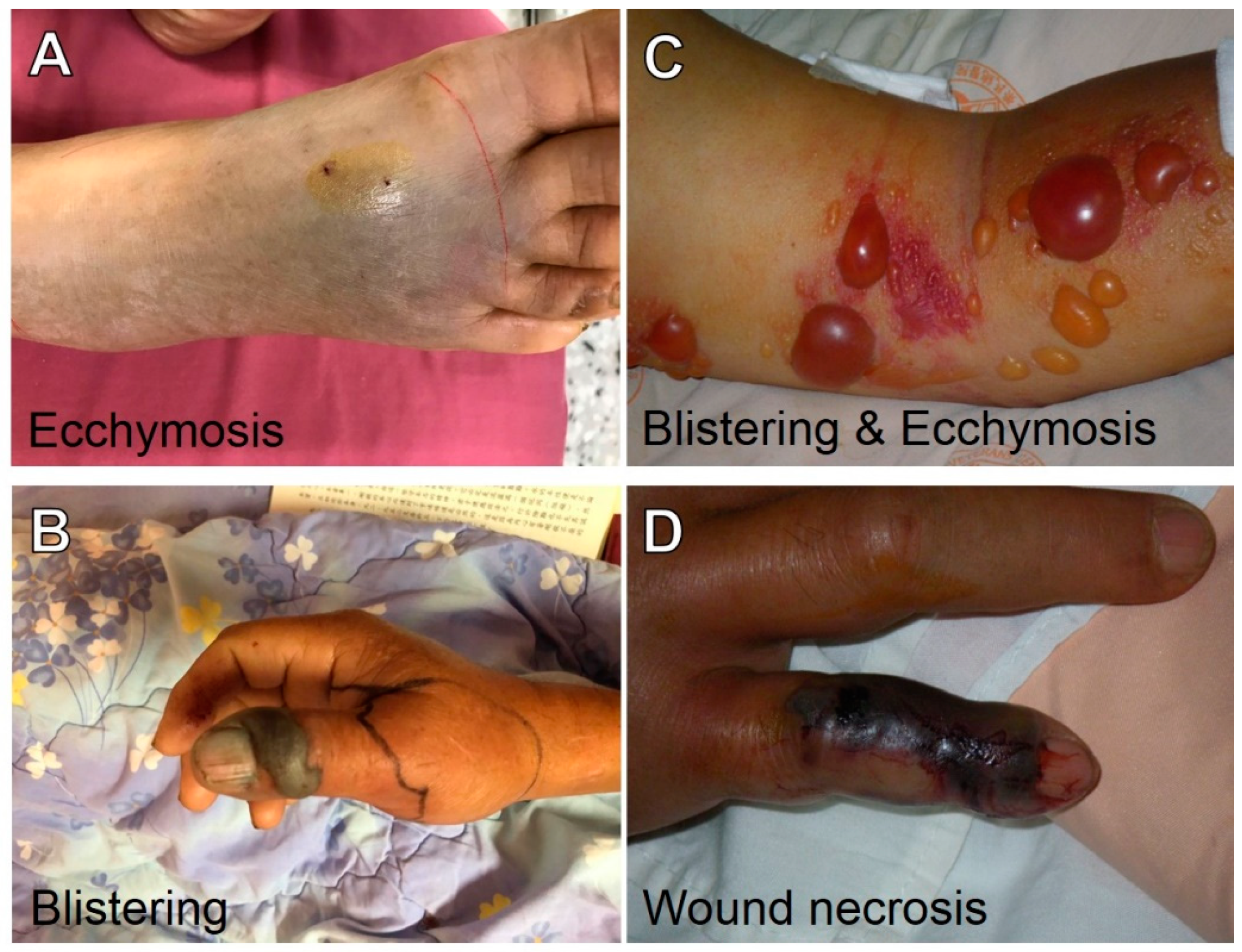 Toxins 14 00643 g004 Toxins 14 00643 g004