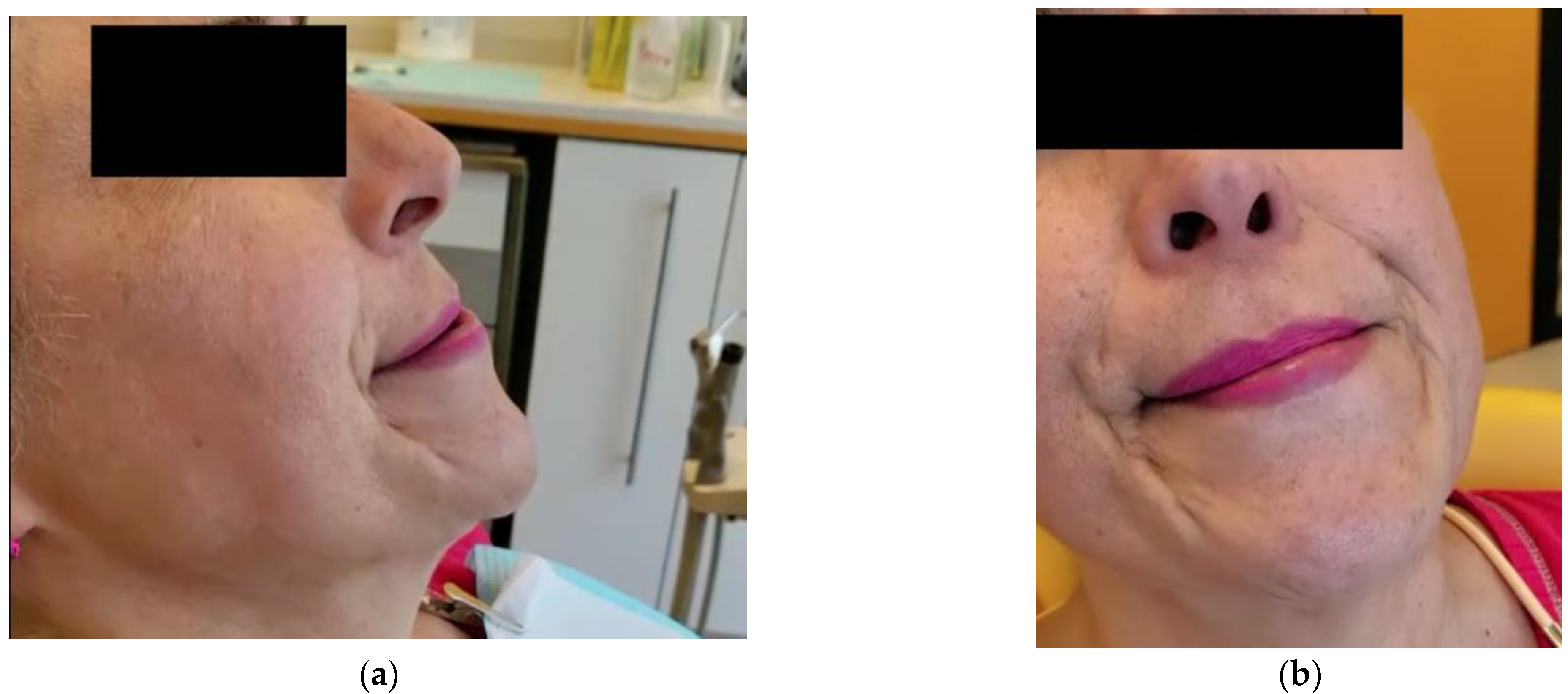 Toxins 14 00680 g001 550