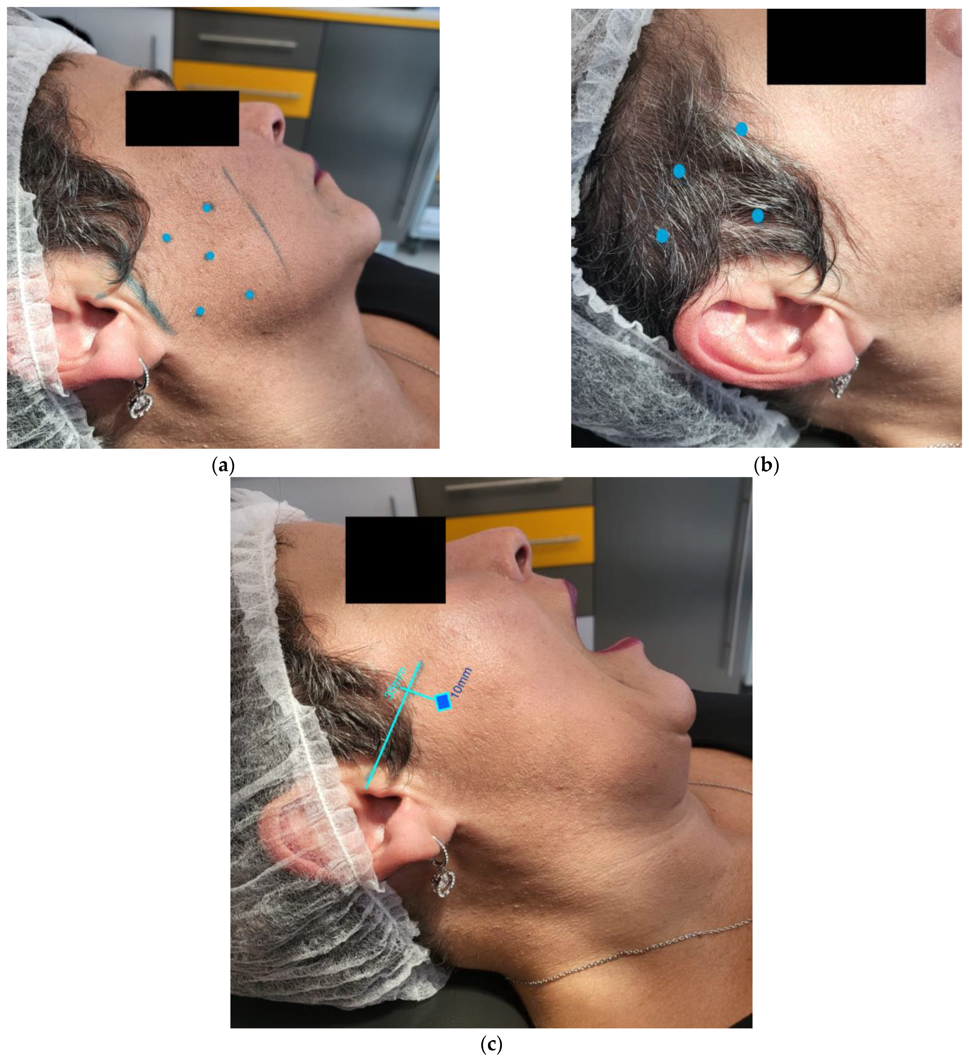 Toxins 14 00680 g002 550