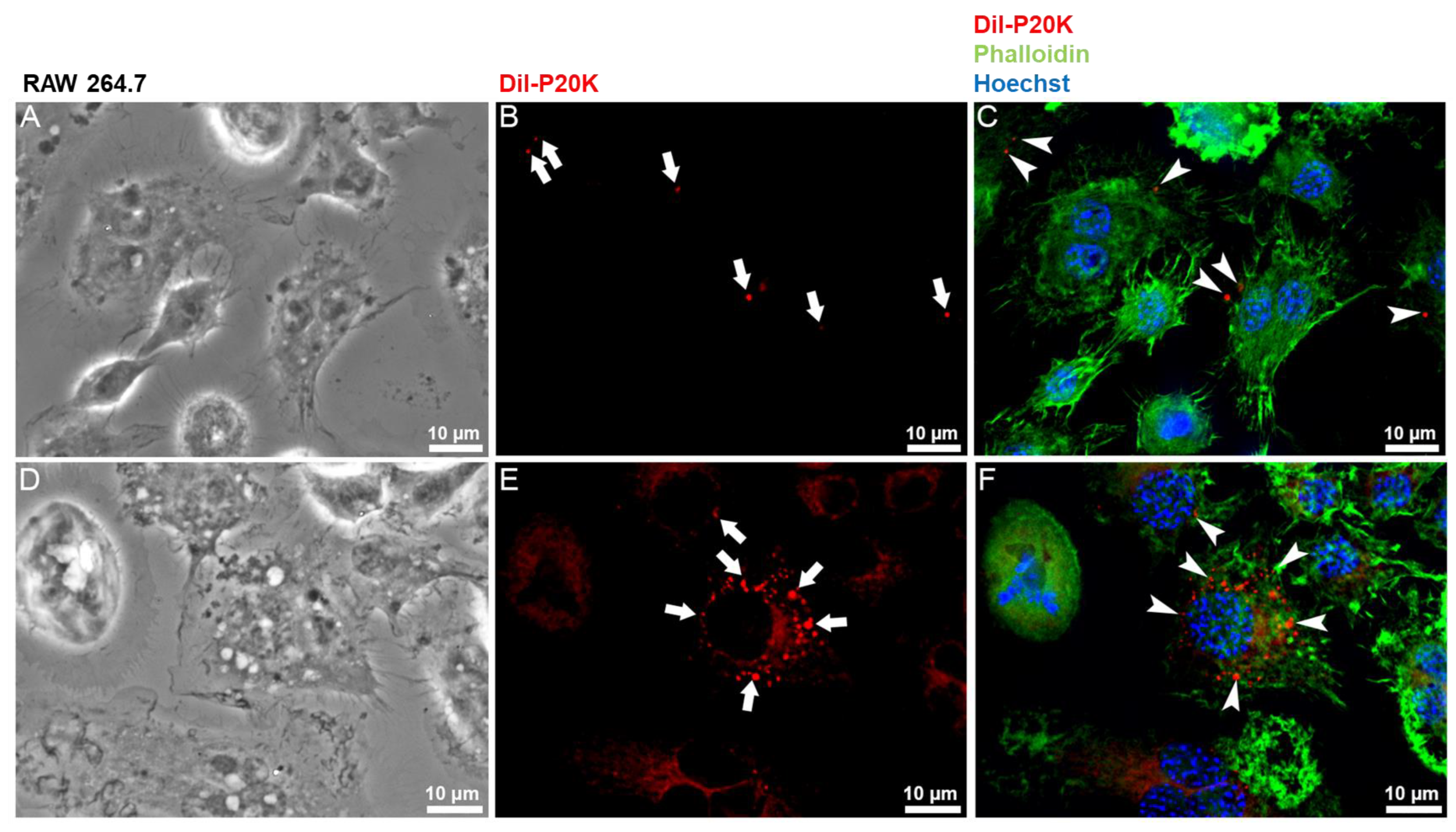 Toxins 14 00806 g004 Toxins 14 00806 g004