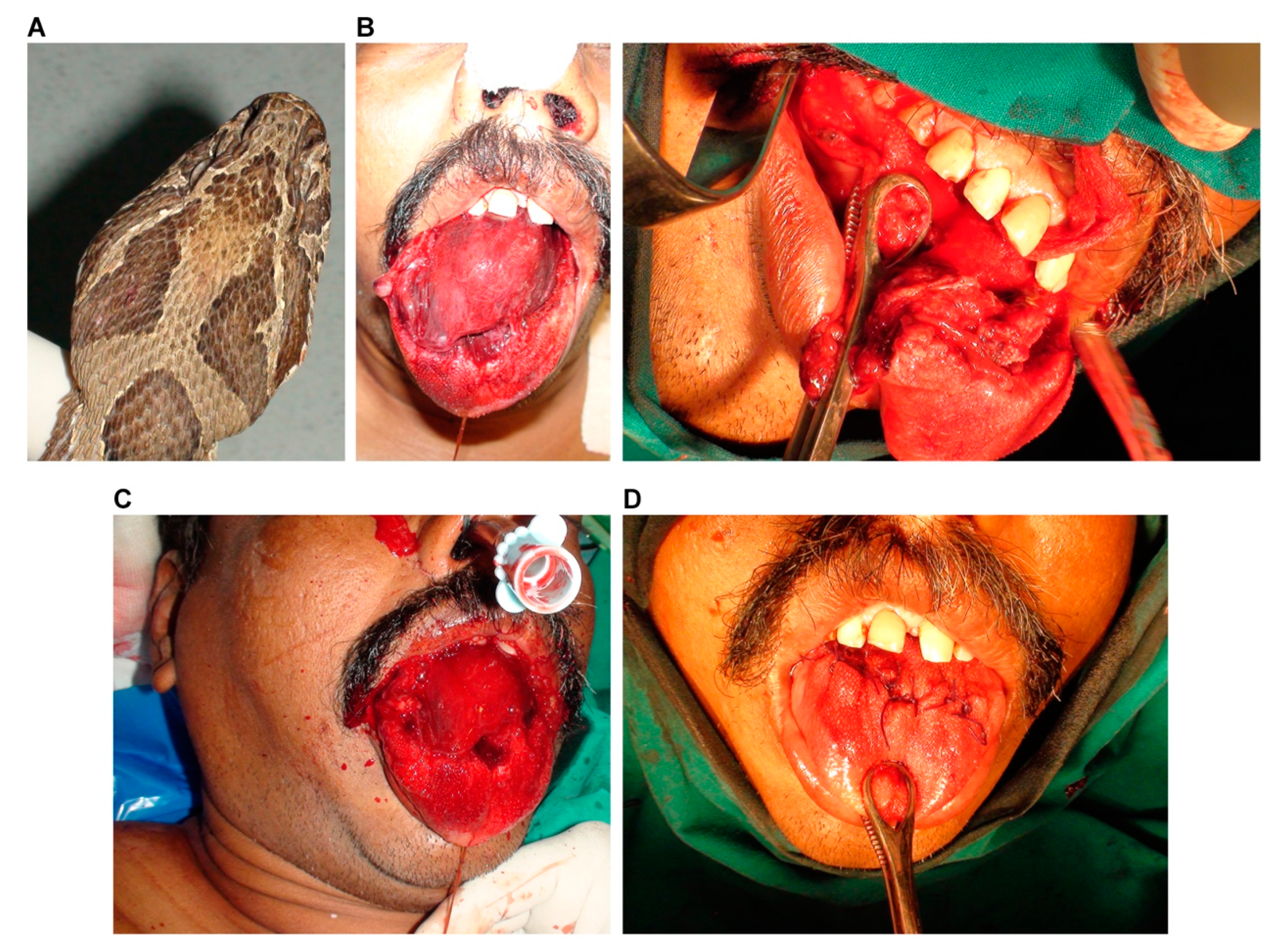 Toxins 14 00817 g001 Toxins 14 00817 g001