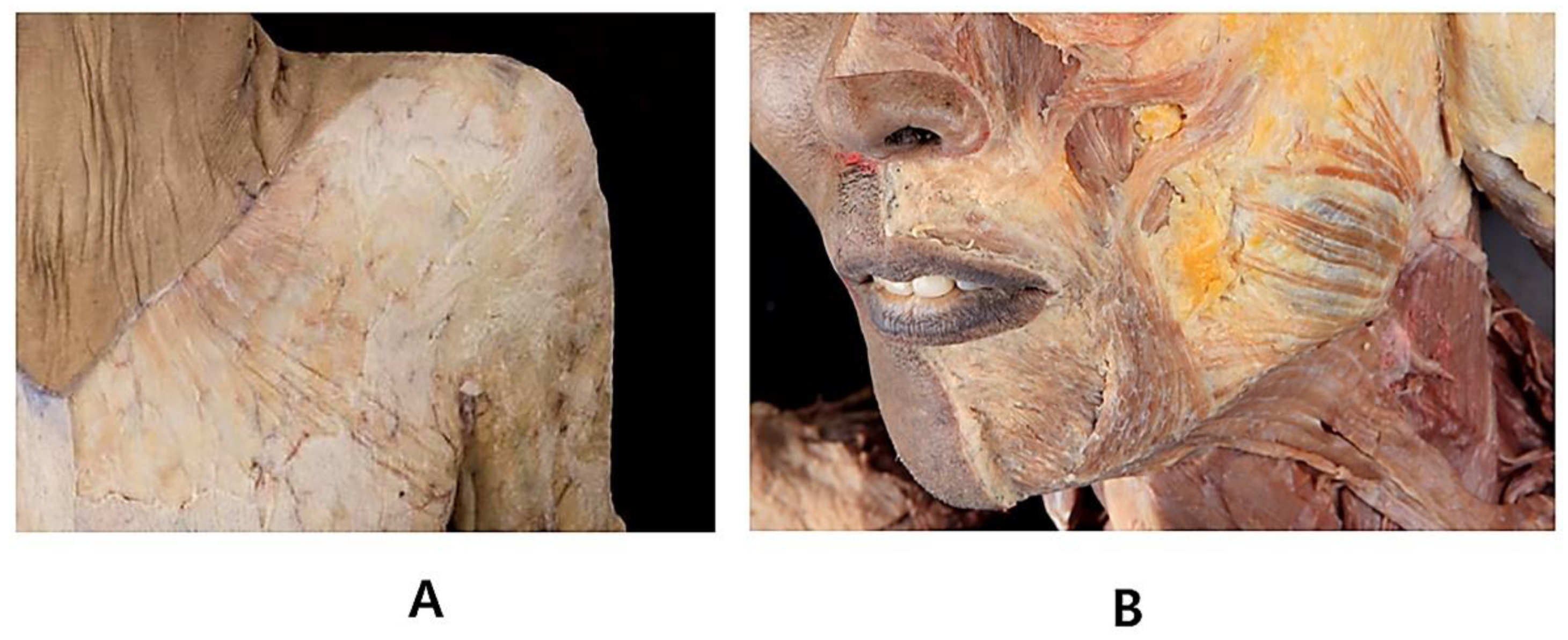 Toxins 14 00868 g003